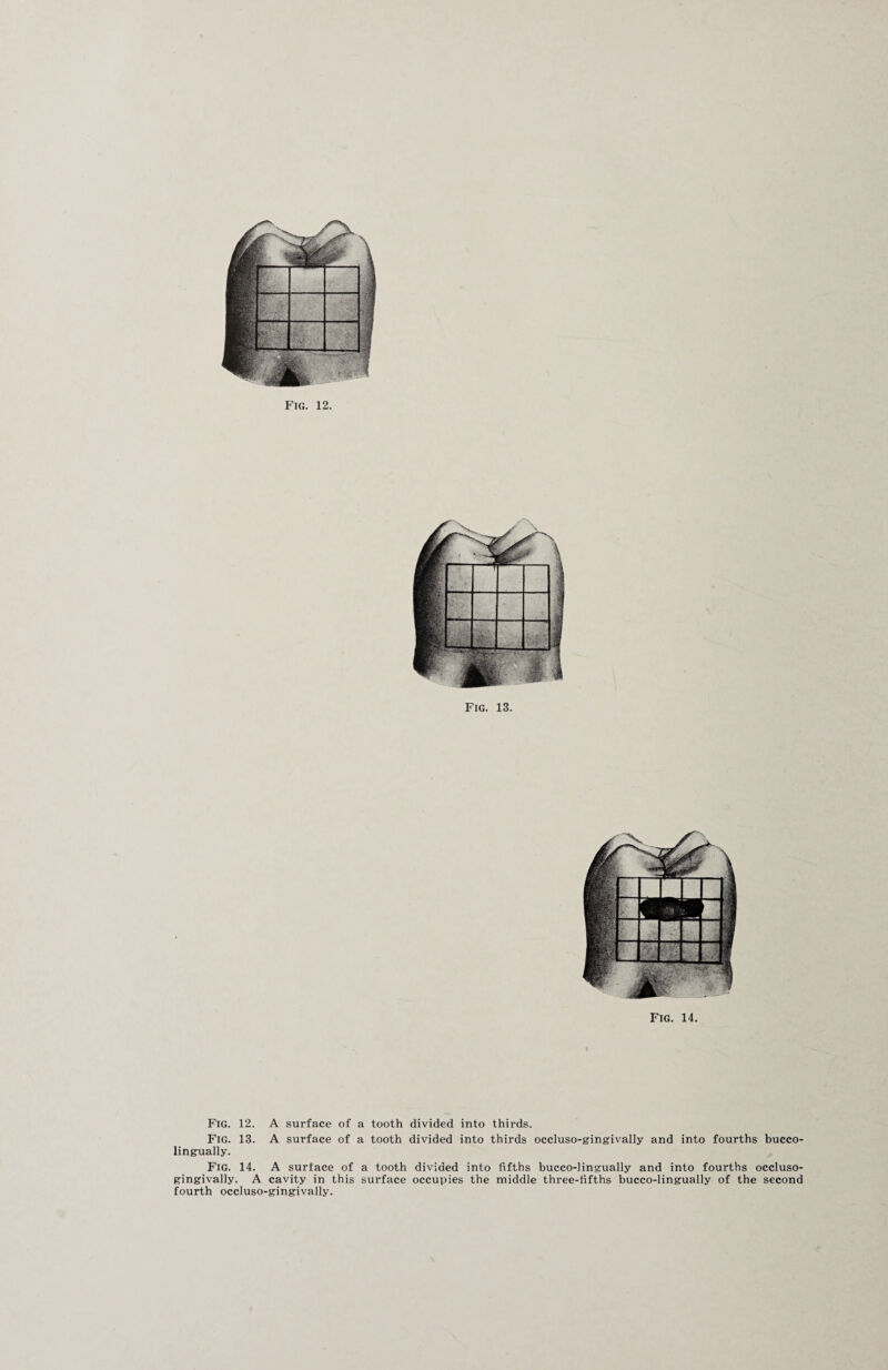 Fig. 13. Fig. 14. Fig. 12. A surface of a tooth divided into thirds. Fig. 13. A surface of a tooth divided into thirds occluso-gingivally and into fourths bucco- lingually. Fig. 14. A surface of a tooth divided into fifths bucco-lingually and into fourths occluso- gingivally. A cavity in this surface occupies the middle three-fifths bucco-lingually of the second fourth occluso-gingivally.