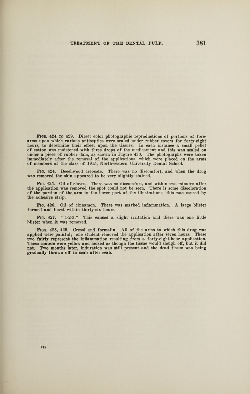 Figs. 424 to 429. Direct color photographic reproductions of portions of fore¬ arms upon which various antiseptics were sealed under rubber covers for forty-eight hours, to determine their effect upon the tissues. In each instance a small pellet of cotton was moistened with three drops of the medicament and this was sealed on under a piece of rubber dam, as shown in Figure 430. The photographs were taken immediately after the removal of the applications, which were placed on the arms of members of the class of 1915, Northwestern University Dental School. Fig. 424. Beechwood creosote. There was no discomfort, and when the drug was removed the skin appeared to be very slightly stained. Fig. 425. Oil of cloves. There was no discomfort, and within two minutes after the application was removed the spot could not be seen. There is some discoloration of the portion of the arm in the lower part of the illustration; this was caused by the adhesive strip. Fig. 426. Oil of cinnamon. There was marked inflammation. A large blister formed and burst within thirty-six hours. Fig. 427. “ 1-2-3.” This caused a slight irritation and there was one little blister when it was removed. Figs. 428, 429. Cresol and formalin. All of the arms to which this drug was applied were painful; one student removed the application after seven hours. These two fairly represent the inflammation resulting from a forty-eight-hour application. These centers were yellow and looked as though the tissue would slough off, but it did not. Two months later, induration was still present and the dead tissue was being gradually thrown off in scab after scab. 22a