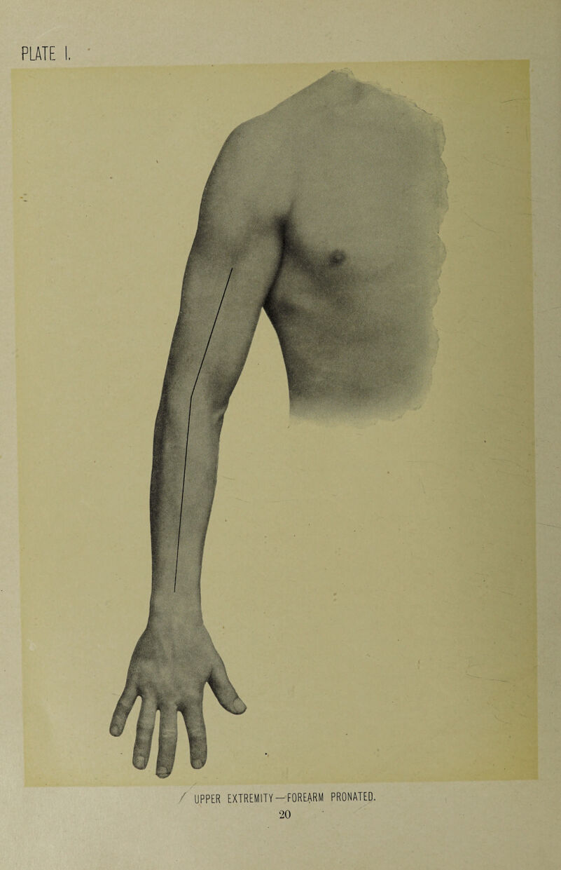 / UPPER EXTREMITY-FOREARM PRORATED.