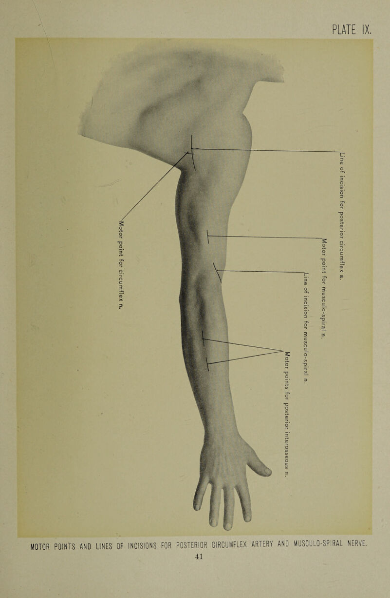 MOTOR POINTS AND LINES OF INCISIONS FOR POSTERIOR CIRCUMFLEX ARTERY AND MUSCULO-SPIRAL NERVE. Line of incision for posterior circumflex a.