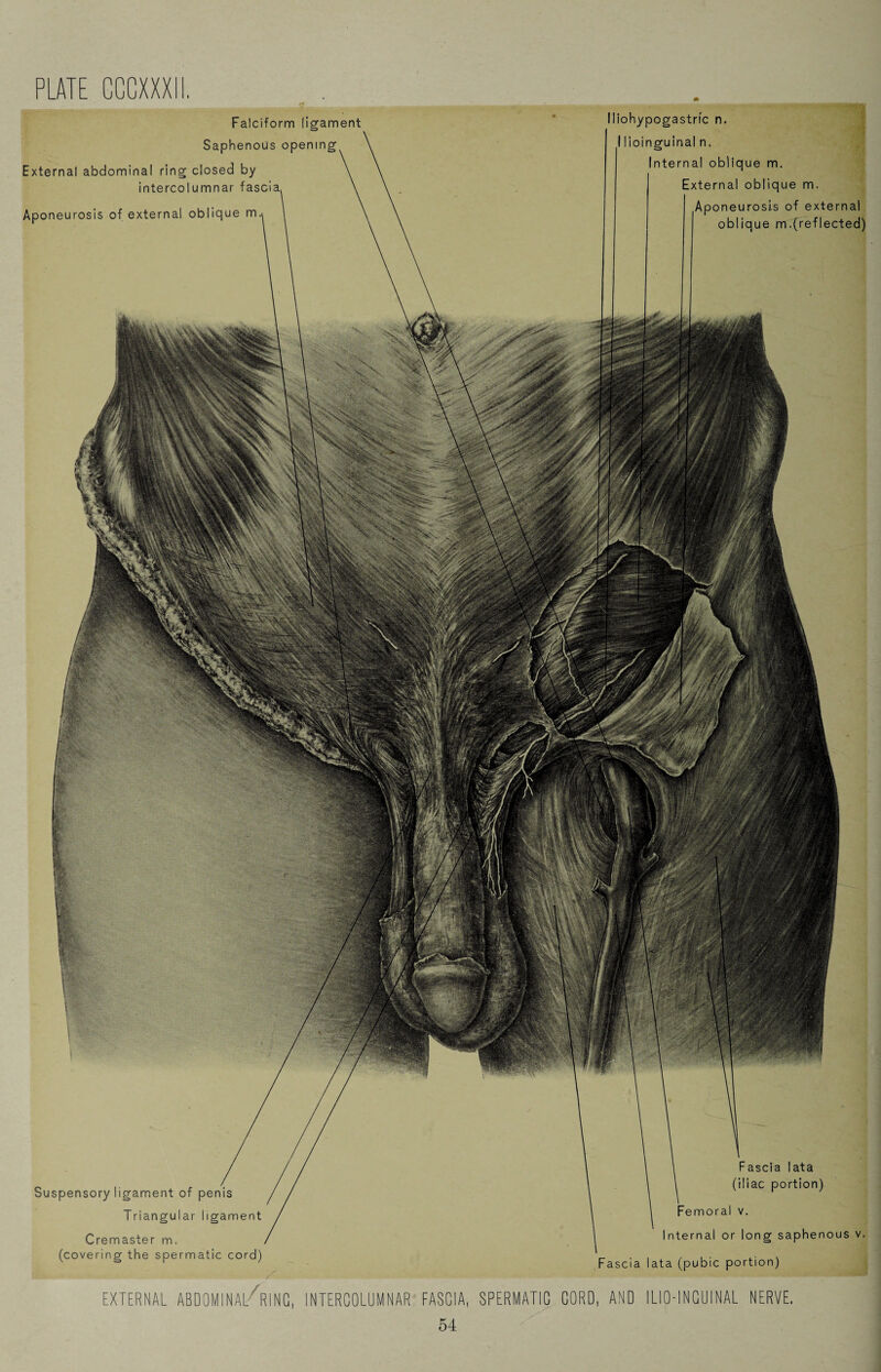 Suspensory ligament of penis Triangular ligament Cremaster m. (covering the spermatic cord) Fascia lata (iliac portion) Femoral v. Internal or long saphenous v. Fascia lata (pubic portion) Falciform ligament Saphenous opening External abdominal ring closed by intercolumnar fasci Aponeurosis of external oblique m Iliohypogastric n. I lioinguinal n. Internal oblique m. External oblique m. Aponeurosis of external oblique m.(reflected) EXTERNAL ABDOMINAL'TlNC, INTERCOLUMNAR FASCIA, SPERMATIC CORD, AND ILI0-INCU1NAL NERVE.