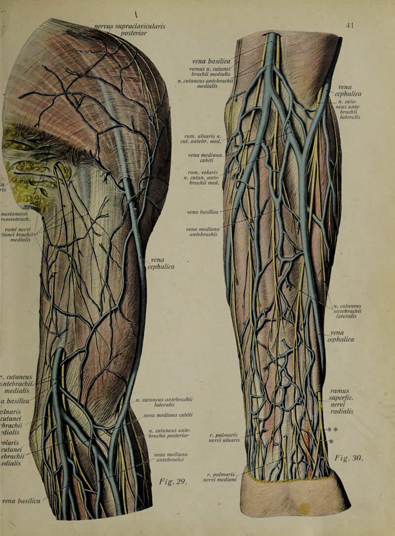 vena basilica n. cut emeus nntebrachii lateralis vena cephalica •\ cutaneus ttntebrachiL medialis a basilica' ulnaris cutanei 1brach ii tdialis •olaris cutanei ebrachii edialis vena basilica ramus n. brachii medialis vena mediana antebrachii n. cutaneus antebrachii lateralis ,vena mediana cubiti ramus superfic. nervi radialis vena mediana vena cephalica cut. antebr. med. cubiti ram. volaris n. cutan. ante¬ brachii med. vena cephalica nastornosib rcostobrach. rami nervi tanei brachii medialis n. cutaneus ante¬ brachii posterior r. palmaris nervi ulnaris n. cuta¬ neus ante¬ brachii lateralis r. palmaris nervi mediani