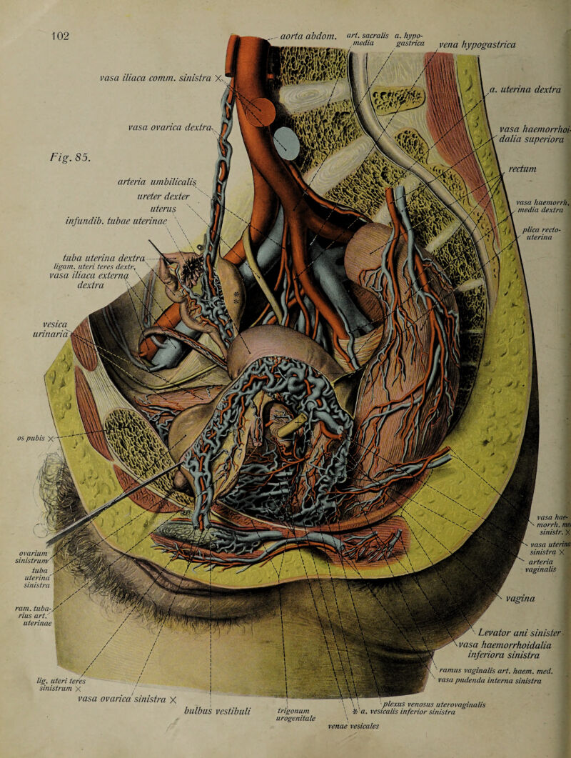 . media gastrica vena hypogastrica vasa iliaca comm, sinistra X- a. uterina dextra vasa ovarica dextra vasa haemorrhoi- ' dalia superiora Fig. 85. rectum arteria umbilicalis ureter dexter uterus \ infundib. tubae uterinac \ vasa haemorrh. / V,- media dextra tuba, uterina dextra - ligam. uteri teres dextrx vasa iliaca externq. \ b' dextra vesica urinaria / ', vVi i\ plan recto uterma os pubis X vasa hae- morrh. met sinistr. X ovarium sinistrunr'i&SS, tuba Jph uterina ^ sinistra ™ vasa uterina sinistra X arteria vaginalis ram. tuba-/' rius art.' uterinae lig. uteri teCes / sinistrum X / vasa ovarica sinistra X Levator ani sinister ■ vasa haemorrhoidalia inferiora sinistra p\ ' ramus vaginalis art. haem. med. vasa pudenda interna sinistra bulbus vestibuli trigonum urogenitale \ \ \ plexus venosus uterovaginalis \ -X- «. vesicalis inferior sinistra venae vesicates