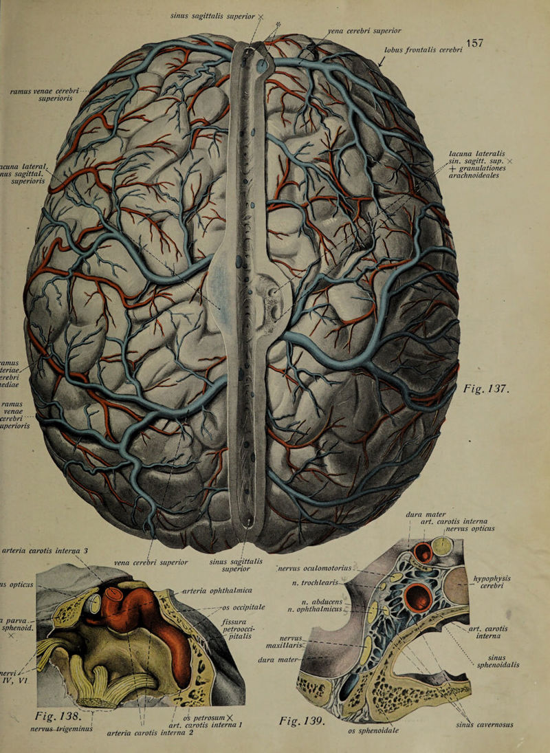 yena cerebri superior lobus frontalis cerebri ramus venae cerebri superioris lacuna lateralis sin. sagitt. sup. X -J- granulationes arachnoideales icuna lateral nus sagittal.' superioris ■amus teriae. erebri lediae ramus venae cerebri uperioris dura mater i art. carotis interna I , ,nervus opticus arteria carotis interna 3 sinus sagittalis superior vena cerebri superior nervus oculomotorius hypophysis ' cerebri n. trochlear is iarteria ophthalmica n. abducens n. ophthalmicus. ~os occipitale fissura petroocci- pitalis 2 parva.- sphenoid. art. carotis interna nervus_ maxi Haris: sinus sphenoidalis dura mater nervi/' ' IV, VI j o!s petrosum X art. carotis interna 1 sinus cavernosus nervus-trigeminus os sphenoidale arteria carotis interna 2