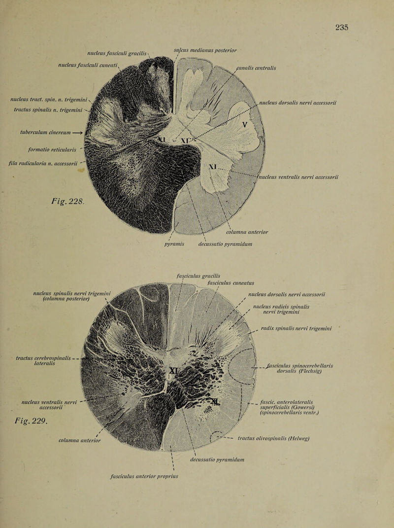 tuberculum cinereum ■ nucleus fasciculi gracilis - nucleus fasciculi cun eatt\ nucleus tract, spin. n. trigemini tractus spinalis n. trigemini nucleus dorsalis nervi accessorii formatio reticularis  fila radicularia n. accessorii ' ventralis nervi accessorii Fig. 228. columna anterior sulcus medianus posterior centralis pyramis decussatio pyramidum fasciculus gracilis fasciculus cuneatus nucleus dorsalis nervi accessorii / / nucleus radicis spinalis / nervi trigemini radix spinalis nervi trigemini _fasciculus spinocerebellaris dorsalis (Flechsig) _ _ fa seic. antero/atera/is superficialis (Gowersi) (spinocerebellaris ventr.) — tractus olivospinalis (Helweg) decussatio pyramidum nucleus spinalis nervi trigemini (columna posterior) \ tractus cerebrospinalis — lateralis Fig. 229. / columna anterior nucleus ventralis nervi accessorii fasciculus anterior proprius