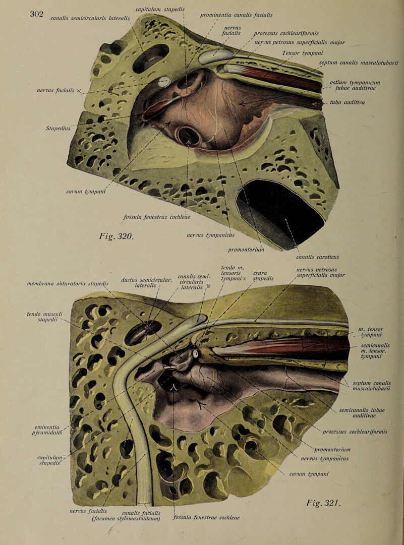 cavum tympani fossula fenestrae cochleae Fig. 320. nervus tympanicäs promontorium prominentia canalis facialis nervus facialis processus cochleariformis nervus petrosus superficialis major 'rensor tympani septum canalis musculotubarii ostium tympanicum -- tubae auditivae ■ tuba auditiva 302 capitulum stapedis canalis semicircularis lateralis. nervus facialis X canalis caroticus \ septum canalis musculotubarii ductus semicircular, lateralis i canalis semi¬ circularis _r:„ tendo m. tensoris crura tympani x stapedis nervus petrosus superficialis major tendo musculi stapedii  eminentia , pyramidalri capitulum , stapedis' Fig. 32F membrana obturatoria stapedis m. tensor . tympani semicanatis m. tensor, tympani nervus facia'lis canalis (foramen I fossula fenestrae cochleae semicanatis tubae auditivae x processus cochleariformis promontorium nervus tympanicus cavum tympani