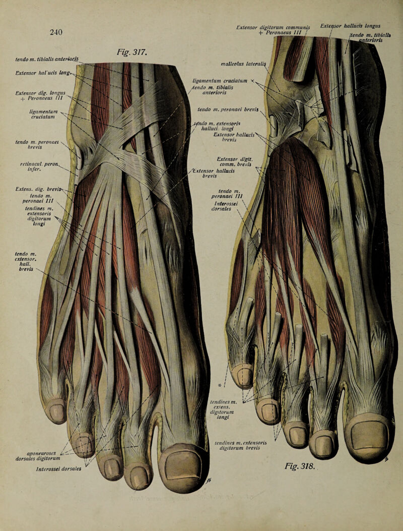 tendo m. tibialis anterioxis Extensor hal'ucis long* Extensor dig. longus -f- Peronneus III ligamentum cruciatum V tendo rn. peronaei \ \ nGBH brevis \ . vjU'vV ' UM retinacul. peron infer. Extens. dig. brevisx Jr tendo m. peronaei III x , tendines m. \f. extensor is digitorum V longi tendo m. Extensor digitorum communis Extepsor hallucis longus + Peronaeus 111 i ! i'tendo m. tibialis terioris Fig. 317. aponeuroses U.<-— dorsales digitorum rr , Interossei dorsales
