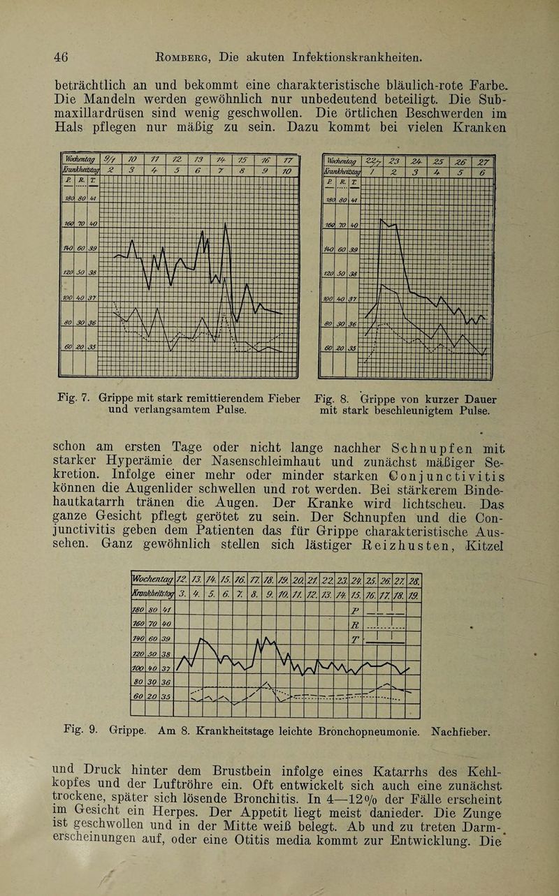 beträchtlich an und bekommt eine charakteristische bläulich-rote Farbe. Die Mandeln werden gewöhnlich nur unbedeutend beteiligt. Die Sub- maxillardrüsen sind wenig geschwollen. Die örtlichen Beschwerden im Hals pflegen nur mäßig zu sein. Dazu kommt bei vielen Kranken Fig. 7. Grippe mit stark remittierendem Fieber Fig. 8. Grippe von kurzer Dauer mit stark beschleunigtem Pulse. und verlangsamtem Pulse. schon am ersten Tage oder nicht lange nachher Schnupfen mit starker Hyperämie der Nasenschleimhaut und zunächst mäßiger Se¬ kretion. Infolge einer mehr oder minder starken Conjunctivitis können die Augenlider schwellen und rot werden. Bei stärkerem Binde¬ hautkatarrh tränen die Augen. Der Kranke wird lichtscheu. Das ganze Gesicht pflegt gerötet zu sein. Der Schnupfen und die Con¬ junctivitis geben dem Patienten das für Grippe charakteristische Aus¬ sehen. Ganz gewöhnlich stellen sich lästiger Reizhusten, Kitzel Fig. 9. Grippe. Am 8. Krankheitstage leichte Bronchopneumonie. Nachfieber. und Druck hinter dem Brustbein infolge eines Katarrhs des Kehl¬ kopfes und der Luftröhre ein. Oft entwickelt sich auch eine zunächst trockene, später sich lösende Bronchitis. In 4—12% der Fälle erscheint im Gesicht ein Herpes. Der Appetit liegt meist danieder. Die Zunge ist geschwollen und in der Mitte weiß belegt. Ab und zu treten Darm-^ erschemungen auf, oder eine Otitis media kommt zur Entwicklung. Die