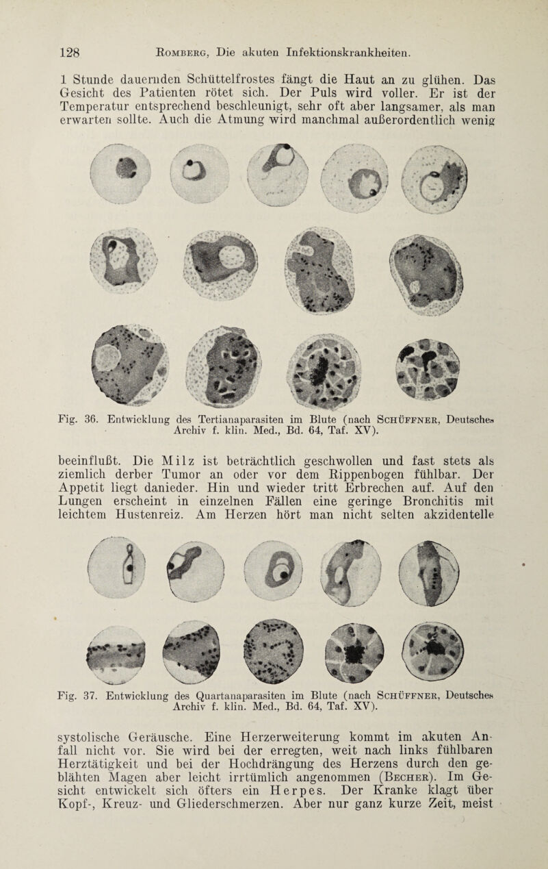 1 Stunde dauernden Schüttelfrostes fängt die Haut an zu glühen. Das Gesicht des Patienten rötet sich. Der Puls wird voller. Er ist der Temperatur entsprechend beschleunigt, sehr oft aber langsamer, als man erwarten sollte. Auch die Atmung wird manchmal außerordentlich wenig Fig. 36. Entwicklung des Tertianaparasiten im Blute (nach Schüffner, Deutsche» Archiv f. klin. Med., Bd. 64, Taf. XV). beeinflußt. Die Milz ist beträchtlich geschwollen und fast stets als ziemlich derber Tumor an oder vor dem Rippenbogen fühlbar. Der Appetit liegt danieder. Hin und wieder tritt Erbrechen auf. Auf den Lungen erscheint in einzelnen Fällen eine geringe Bronchitis mit leichtem Hustenreiz. Am Herzen hört man nicht selten akzidentelle Fig. 37. Entwicklung des Quartanaparasiten im Blute (nach Schüffner, Deutsches Archiv f. klin. Med., Bd. 64, Taf. XV). systolische Geräusche. Eine Herzerweiterung kommt im akuten An¬ fall nicht vor. Sie wird bei der erregten, weit nach links fühlbaren Herztätigkeit und bei der IPochdrängung des Herzens durch den ge¬ blähten Magen aber leicht irrtümlich angenommen (Becher). Im Ge¬ sicht entwickelt sich öfters ein Herpes. Der Kranke klagt über Kopf-, Kreuz- und Gliederschmerzen. Aber nur ganz kurze Zeit, meist