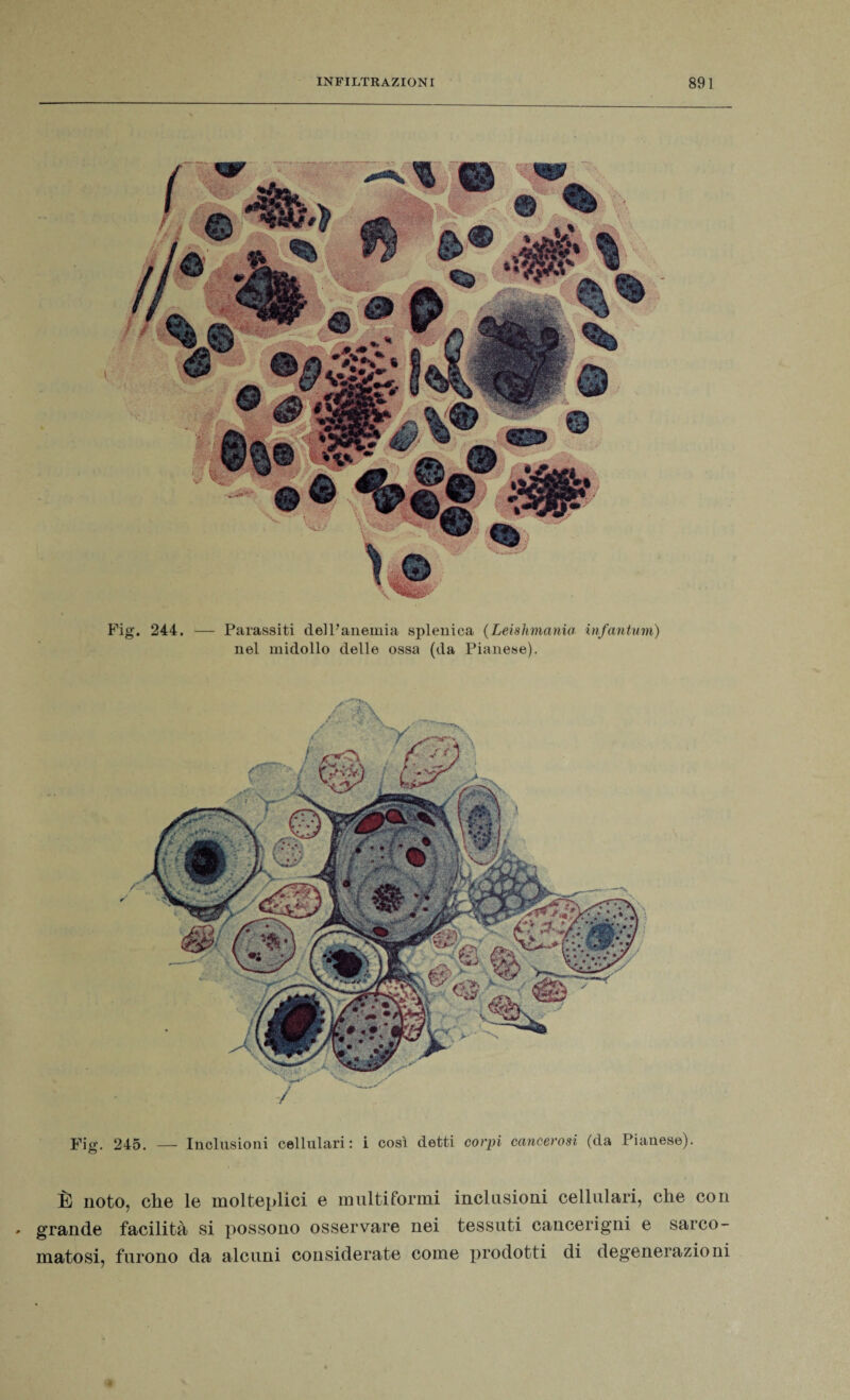 Fig. 245. — Inclusioni cellulari: i cosi detti corpi cancerosi (da Pianese). È noto, che le molteplici e multiformi inclusioni cellulari, che con grande facilità si possono osservare nei tessuti cancerigni e sarco- matosi, furono da alcuni considerate come prodotti di degenerazioni Fig. 244. — Parassiti dell’anemia spleuica (Leishmania infantum) nel midollo delle ossa (da Pianese).