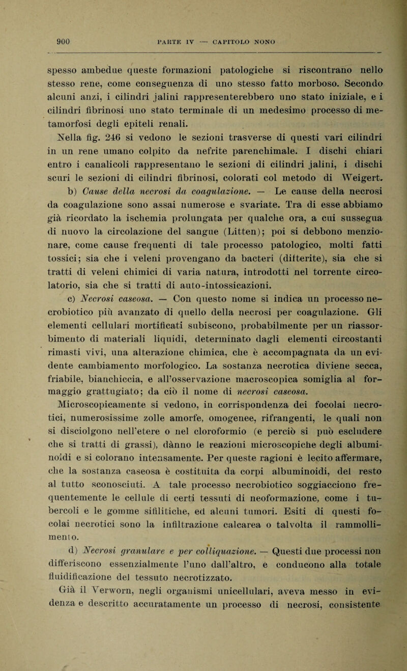 spesso ambedue queste formazioni patologiche si riscontrano nello stesso rene, come conseguenza di uno stesso fatto morboso. Secondo alcuni anzi, i cilindri jalini rappresenterebbero uno stato iniziale, e i cilindri fibrinosi uno stato terminale di un medesimo processo di me¬ tamorfosi degli epiteli renali. Nella fìg. 246 si vedono le sezioni trasverse di questi vari cilindri in un rene umano colpito da nefrite parenchimale. I dischi chiari entro i canalicoli rappresentano le sezioni di cilindri jalini, i dischi scuri le sezioni di cilindri fibrinosi, colorati col metodo di Weigert. b) Cause della necrosi da coagulazione. — Le cause della necrosi da coagulazione sono assai numerose e svariate. Tra di esse abbiamo già ricordato la ischemia prolungata per qualche ora, a cui sussegua di nuovo la circolazione del sangue (Litten); poi si debbono menzio¬ nare, come cause frequenti di tale processo patologico, molti fatti tossici; sia che i veleni provengano da bacteri (difterite), sia che si tratti di veleni chimici di varia natura, introdotti nel torrente circo¬ latorio, sia che si tratti di auto-intossicazioni. c) Necrosi caseosa. — Con questo nome si indica un processo ne¬ crobiotico più avanzato di quello della necrosi per coagulazione. Gli elementi cellulari mortificati subiscono, probabilmente per un riassor¬ bimento di materiali liquidi, determinato dagli elementi circostanti rimasti vivi, una alterazione chimica, che è accompagnata da un evi¬ dente cambiamento morfologico. La sostanza necrotica diviene secca, friabile, bianchiccia, e all’osservazione macroscopica somiglia al for¬ maggio grattugiato; da ciò il nome di necrosi caseosa. Microscopicamente si vedono, in corrispondenza dei focolai necro¬ tici, numerosissime zolle amorfe, omogenee, rifrangenti, le quali non si disciolgono nell’etere o nel cloroformio (e perciò si può escludere che si tratti di grassi), dànno le reazioni microscopiche degli albumi- noidi e si colorano intensamente. Per queste ragioni è lecito affermare, che la sostanza caseosa è costituita da corpi albuminoidi, del resto al tutto sconosciuti. A tale processo necrobiotico soggiacciono fre¬ quentemente le cellule di certi tessuti di neoformazione, come i tu¬ bercoli e le gomme sifilitiche, ed alcuni tumori. Esiti di questi fo¬ colai necrotici sono la infiltrazione calcarea o talvolta il rammolli¬ mento. d) Necrosi granulare e per colliquazione. — Questi due processi non differiscono essenzialmente l’uno dall’altro, e conducono alla totale fluidificazione dei tessuto necrotizzato. Già il Verworn, negli organismi unicellulari, aveva messo in evi¬ denza e descritto accuratamente un processo di necrosi, consistente