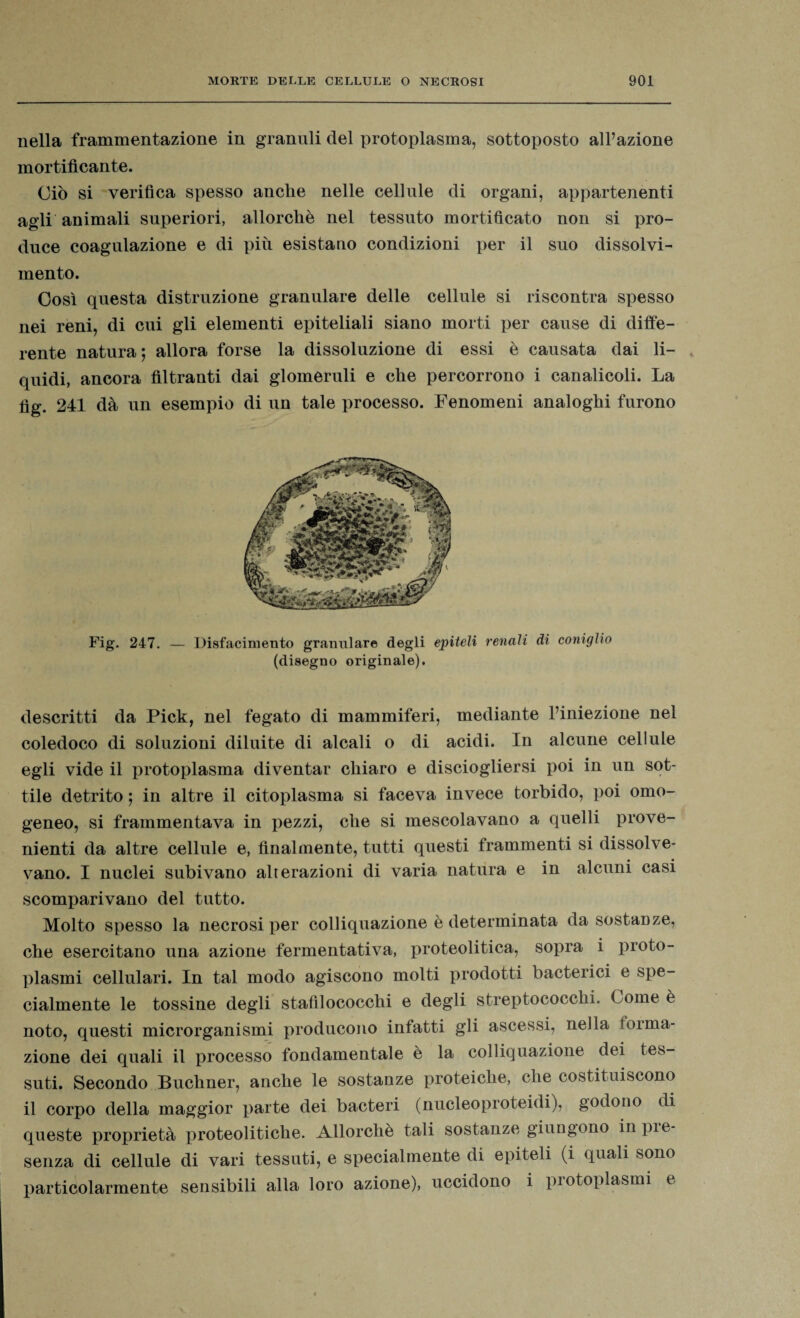 nella frammentazione in granuli del protoplasma, sottoposto all’azione mortificante. Ciò si verifica spesso anche nelle cellule di organi, appartenenti agli animali superiori, allorché nel tessuto mortificato non si pro¬ duce coagulazione e di più esistano condizioni per il suo dissolvi¬ mento. Così questa distruzione granulare delle cellule si riscontra spesso nei reni, di cui gli elementi epiteliali siano morti per cause di diffe¬ rente natura ; allora forse la dissoluzione di essi è causata dai li¬ quidi, ancora filtranti dai glomeruli e che percorrono i canalicoli. La fig. 241 dà un esempio di un tale processo. Fenomeni analoghi furono Fig. 247. — Disfacimento granulare degli epiteli renali di coniglio (disegno originale). descritti da Pick, nel fegato di mammiferi, mediante l’iniezione nel coledoco di soluzioni diluite di alcali o di acidi. In alcune cellule egli vide il protoplasma diventar chiaro e disciogliersi poi in un sot¬ tile detrito ; in altre il citoplasma si faceva invece torbido, poi omo¬ geneo, si frammentava in pezzi, che si mescolavano a quelli prove¬ nienti da altre cellule e, finalmente, tutti questi frammenti si dissolve¬ vano. I nuclei subivano alterazioni di varia natura e in alcuni casi scomparivano del tutto. Molto spesso la necrosi per colliquazione è determinata da sostanze, che esercitano una azione fermentativa, proteolitica, sopra i proto¬ plasmi cellulari. In tal modo agiscono molti prodotti bacterici e spe¬ cialmente le tossine degli stafilococchi e degli streptococchi. Come è noto, questi microrganismi producono infatti gli ascessi, nella toima- zione dei quali il processo fondamentale è la colliquazione dei tes¬ suti. Secondo Buchner, anche le sostanze proteiche, che costituiscono il corpo della maggior parte dei bacteri (nucleoproteidi), godono di queste proprietà proteolitiche. Allorché tali sostanze giungono in pie- senza di cellule di vari tessuti, e specialmente di epiteli (i quali sono particolarmente sensibili alla loro azione), uccidono i protoplasmi e