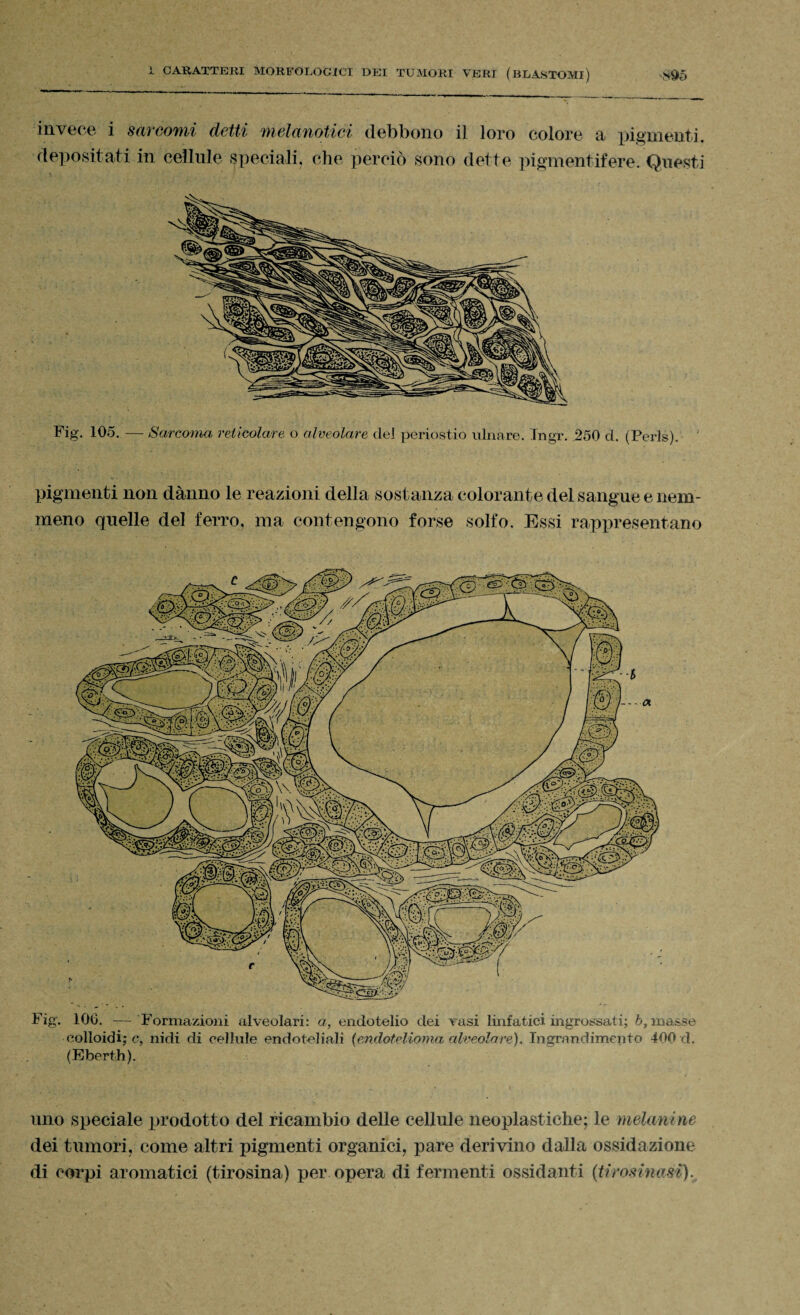 invece i sarcomi detti melanotici debbono il loro colore a pigmenti, depositati in cellule speciali, che perciò sono dette pigmentifere. Questi Fig. 105. — Sarcoma reticolare o alveolare del periostio ulnare. Tngr. 250 d. (Perls). ' pigmenti non danno le reazioni della sostanza colorante del sangue e nem¬ meno quelle del ferro, ma contengono forse solfo. Essi rappresentano Fig. 106. — Formazioni alveolari: a, endotelio dei vasi linfatici ingrossati; 6, masse colloidi; c, nidi di cellule endoteliali (endotelioma alveolare). Ingrandimento 400 d. (Eberth). uno speciale prodotto del ricambio delle cellule neoplastiche; le melanine dei tumori, come altri pigmenti organici, pare derivino dalla ossidazione di corpi aromatici (tirosina) per opera di fermenti ossidanti (tirosinasi).