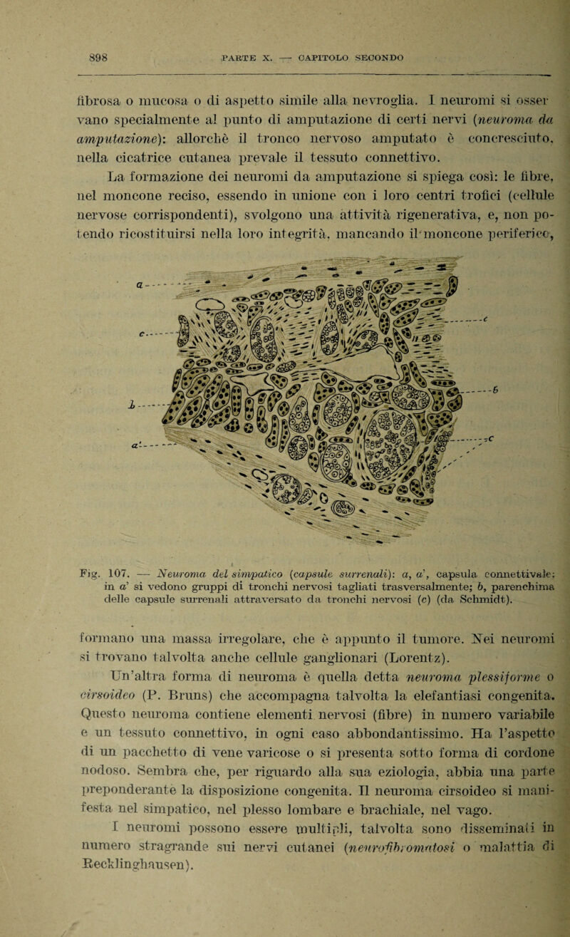 fibrosa o mucosa o di aspetto simile alla nevroglia. I neuromi si ossei* vano specialmente al punto di amputazione di certi nervi (neuroma da amputazione): allorché il tronco nervoso amputato è concresciuto, nella cicatrice cutanea prevale il tessuto connettivo. La formazione dei neuromi da amputazione si spiega così: le fibre, nel moncone reciso, essendo in unione con i loro centri trofici (cellule nervose corrispondenti), svolgono una attività rigenerativa, e, non po¬ tendo ricostituirsi nella loro integrità, mancando il-moncone periferico, Fig. 107. •—• Neuroma del simpatico (capsule surrenuli): a, a\ capsula connetti vale; in a si vedono gruppi di tronchi nervosi tagliati trasversalmente; b, parenchima delle capsule surrenali attraversato da tronchi nervosi (c) (da Schmidt). formano una massa irregolare, che è appunto il tumore. ]STei neuromi si trovano talvolta anche cellule ganglionari (Lorentz). Un’altra forma di neuroma è quella detta neuroma plessiforme o cirsoideo (P. Bruns) che accompagna talvolta la elefantiasi congenita. Questo neuroma contiene elementi nervosi (fibre) in numero variabile e un tessuto connettivo, in ogni caso abbondantissimo. Ha l’aspetto di un pacchetto di vene varicose o si presenta sotto forma di cordone nodoso. Sembra che, per riguardo alla sua eziologia, abbia una parte preponderante la disposizione congenita. Il neuroma cirsoideo si mani¬ festa nel simpatico, nel plesso lombare e brachiale, nel vago. 1 neuromi possono essere multipli, talvolta sono disseminati in numero stragrande sui nervi cutanei (nenrofibrornatosi o malattia eli Ree h 1 i n ghausen ).