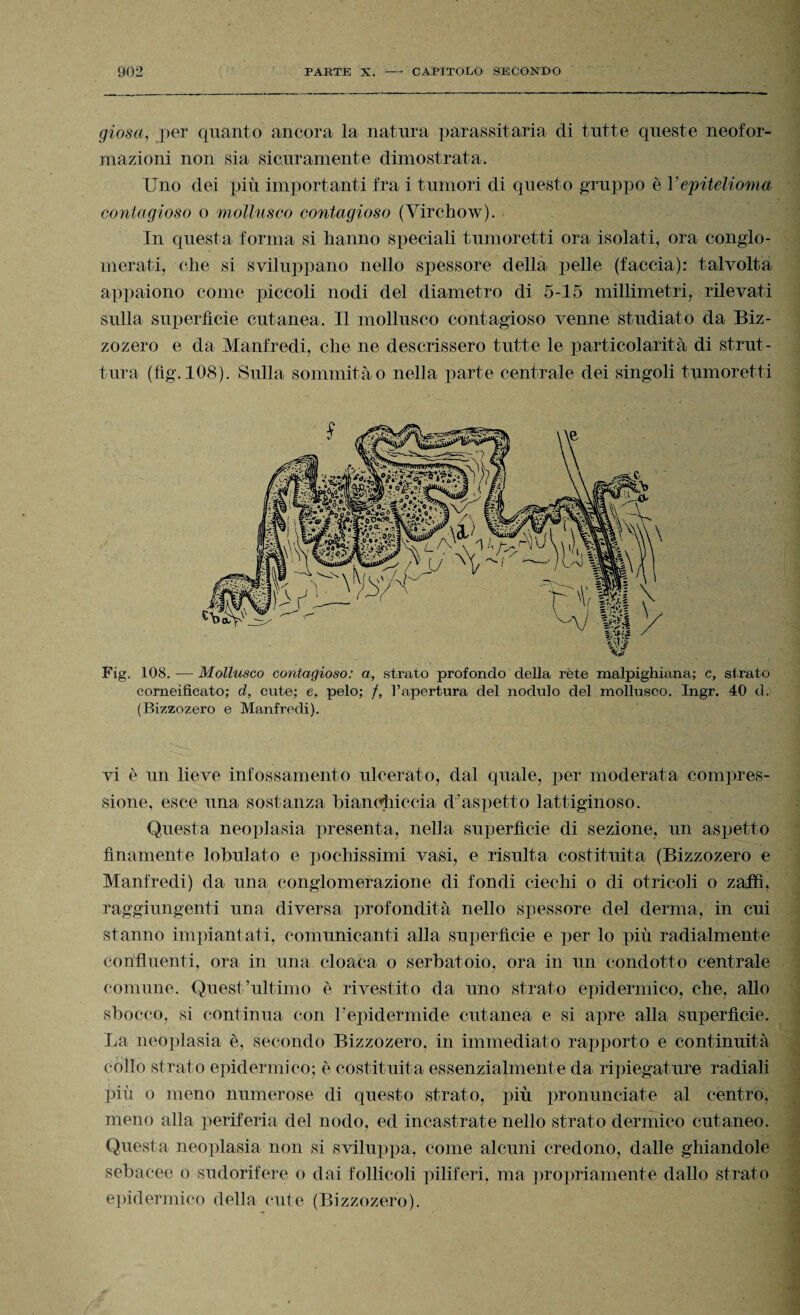 giosa, per quanto ancora la natura parassitarla di tutte queste neofor¬ mazioni non sia sicuramente dimostrata. Uno dei più importanti fra i tumori di questo gruppo è Vepitelioma contagioso o mollusco contagioso (Virchow). In questa forma si hanno speciali tumoretti ora isolati, ora conglo¬ merati, che si sviluppano nello spessore della pelle (faccia): talvolta appaiono come piccoli nodi del diametro di 5-15 millimetri, rilevati sulla superfìcie cutanea. Il mollusco contagioso venne studiato da Biz- zozero e da Manfredi, che ne descrissero tutte le particolarità di strut¬ tura (fìg. 108). Sulla sommità o nella parte centrale dei singoli tumoretti Fig. 108. — Mollusco contagioso: a, strato profondo della rete malpighiana; c, strato corneificato; d, cute; e, pelo; /, l’apertura del nodulo del mollusco. Ingr. 40 d. (Bizzozero e Manfredi). vi è un lieve infossamento ulcerato, dal quale, per moderata compres¬ sione, esce una sostanza bianchiccia d’aspetto lattiginoso. Questa neoplasia presenta, nella superfìcie di sezione, un aspetto finamente lobulato e pochissimi vasi, e risulta costituita (Bizzozero e Manfredi) da una conglomerazione di fondi ciechi o di otricoli o zaffi, raggiungenti una diversa profondità nello spessore del derma, in cui stanno impiantati, comunicanti alla superfìcie e per lo più radialmente Confluenti, ora in una cloaca o serbatoio, ora in un condotto centrale comune. Quest’ultimo è rivestito da uno strato epidermico, che, allo sbocco, si continua con l’epidermide cutanea e si apre alla superfìcie. La neoplasia è, secondo Bizzozero, in immediato rapporto e continuità eolio strato epidermico; è costituita essenzialmente da ripiegature radiali più o meno numerose di questo strato, più pronunciate al centro, meno alla periferia del nodo, ed incastrate nello strato dermico cutaneo. Questa neoplasia non si sviluppa, come alcuni credono, dalle ghiandole sebacee o sudorifere o dai follicoli piliferi, ma propriamente dallo strato epidermico della cute (Bizzozero).