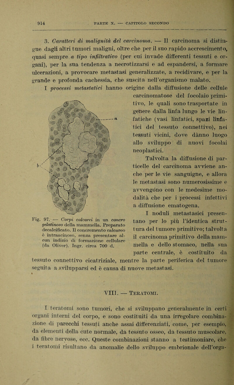 A m * NI * * - m 11 y r® uv-a- £vf%. X ■•-IP/A / '«j» WBBSht '.-;C L ■ 3. Caratteri di malignità del carcinoma, — Il carcinoma si distin¬ gue dagli altri tumori maligni, oltre che per il suo rapido accrescimento, quasi sempre a tipo infiltrativo (per cui invade differenti tessuti e or¬ gani), per la sua tendenza a necrotizzarsi e ad espandersi, a formare ulcerazioni, a provocare metastasi generalizzate, a recidivare, e per la grande e profonda cachessia, che suscita nell’organismo malato. I processi metastatici hanno origine dalla diffusione delle cellule carcinomatose del focolaio primi¬ tivo, le quali sono trasportate in genere dalla linfa lungo le vie lin¬ fatiche (vasi linfatici, spazi linfa¬ tici del tessuto connettivo), nei tessuti vicini, dove danno luogo allo sviluppo di nuovi focolai neoplastici. Talvolta la diffusione di par¬ ticelle del carcinoma avviene an¬ che per le vie sanguigne, e allora le metastasi sono numerosissime e avvengono con le medesime mo¬ dalità che per i processi infettivi a diffusione ematogena. I noduli metastasici presen¬ tano per lo più l’identica strut¬ tura del tumore primitivo; talvolta il carcinoma primitivo della mani- . X- ' } Fig. 97, — Corpi calcarei in un cancro gelatinoso della mammella. Preparato deealcificato. Il concremento calcareo è intraaeinoso, senza presentare al¬ cun indizio di formazione cellulare (da Oliver). Ingr. circa 700 d. niella e dello stomaco, nella sua parte centrale, è costituito da tessuto connettivo cicatriziale, mentre la parte periferica del tumore seguita a svilupparsi ed è causa di nuove metastasi. Vili. — Tesatomi. I ter atomi sono tumori, che si sviluppano generalmente in certi organi interni del corpo, e sono costituiti da una irregolare combina¬ zione di parecchi tessuti anche assai differenziati, come, per esempio, da elementi della cute normale, da tessuto osseo, da tessuto muscolare, da libre nervose, ecc. Queste combinazioni stanno a testimoniare, che i toratomi risultano da anomalie dello sviluppo embrionale dell’orga-