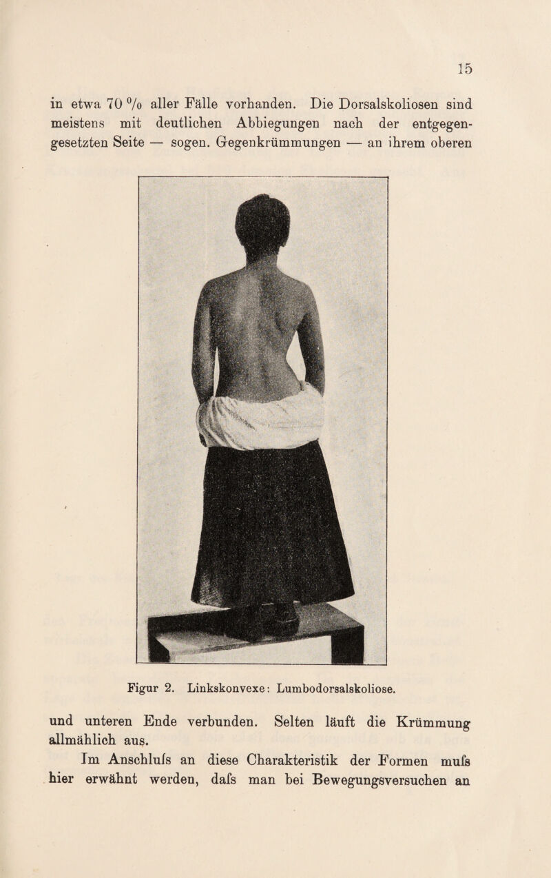 in etwa 70 % aller Fälle vorhanden. Die Dorsalskoliosen sind meistens mit deutlichen Abbiegungen nach der entgegen¬ gesetzten Seite — sogen. Gegenkrümmungen — an ihrem oberen Figur 2. Linkskonvexe: Lumbodorsalskoliose. und unteren Ende verbunden. Selten läuft die Krümmung allmählich aus. Im Anschluls an diese Charakteristik der Formen mufs hier erwähnt werden, dafs man bei Bewegungsversuchen an