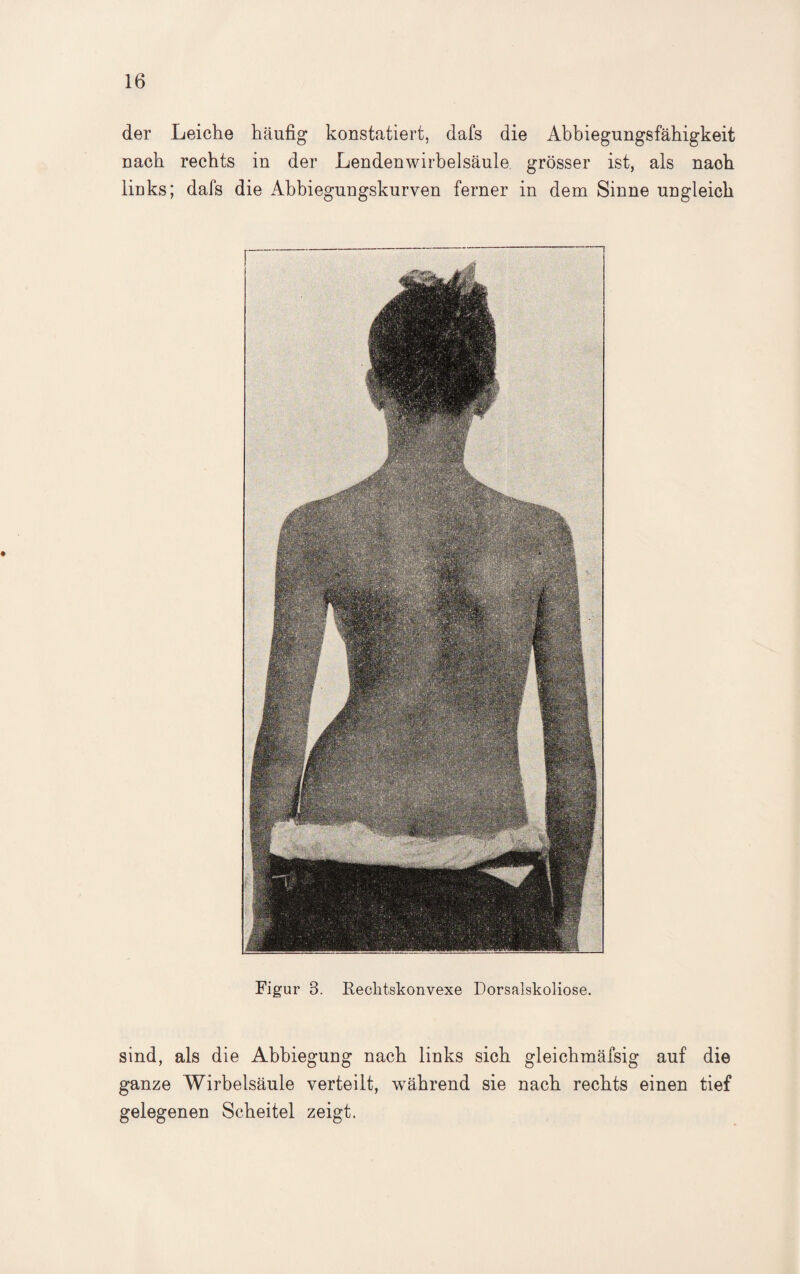 der Leiche häufig konstatiert, dafs die Abbiegungsfähigkeit nach rechts in der Lendenwirbelsäule grösser ist, als naoh links; dafs die Abbiegungskurven ferner in dem Sinne ungleich Figur 3. Rechtskonvexe Dorsalskoliose. sind, als die Abbiegung nach links sich gleichmäfsig auf die ganze Wirbelsäule verteilt, während sie nach rechts einen tief gelegenen Scheitel zeigt.