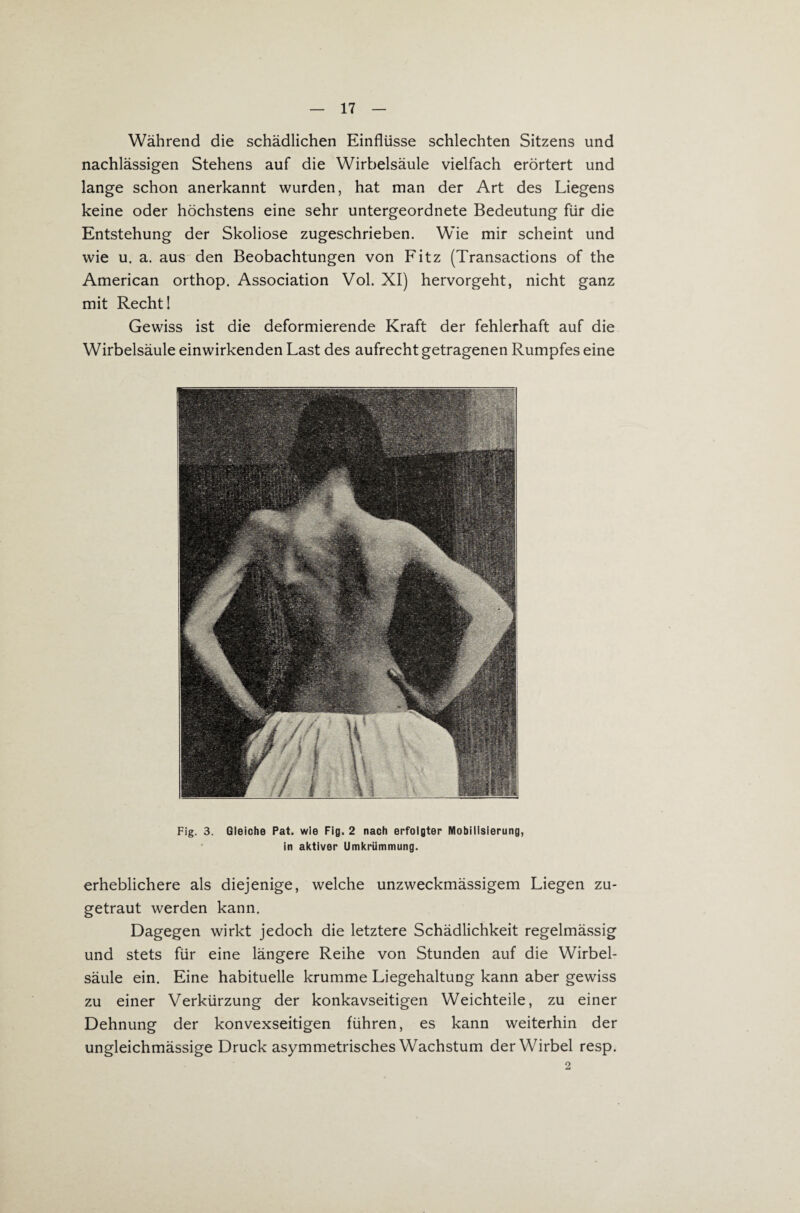 Während die schädlichen Einflüsse schlechten Sitzens und nachlässigen Stehens auf die Wirbelsäule vielfach erörtert und lange schon anerkannt wurden, hat man der Art des Liegens keine oder höchstens eine sehr untergeordnete Bedeutung für die Entstehung der Skoliose zugeschrieben. Wie mir scheint und wie u. a. aus den Beobachtungen von Fitz (Transactions of the American orthop. Association Vol. XI) hervorgeht, nicht ganz mit Recht I Gewiss ist die deformierende Kraft der fehlerhaft auf die Wirbelsäule einwirkenden Last des aufrecht getragenen Rumpfes eine Fig. 3. Gleiche Pat. wie Fig. 2 nach erfolgter Mobilisierung, in aktiver UmkrUmmung. erheblichere als diejenige, welche unzweckmässigem Liegen zu¬ getraut werden kann. Dagegen wirkt jedoch die letztere Schädlichkeit regelmässig und stets für eine längere Reihe von Stunden auf die Wirbel¬ säule ein. Eine habituelle krumme Liegehaltung kann aber gewiss zu einer Verkürzung der konkavseitigen Weichteile, zu einer Dehnung der konvexseitigen führen, es kann weiterhin der ungleichmässige Druck asymmetrisches Wachstum der Wirbel resp. 2