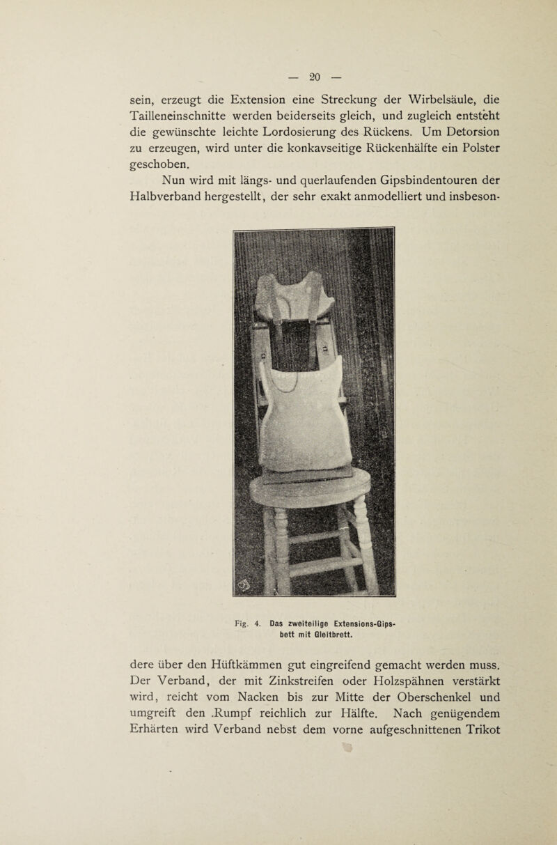 sein, erzeugt die Extension eine Streckung der Wirbelsäule, die Tailleneinschnitte werden beiderseits gleich, und zugleich entsteht die gewünschte leichte Lordosierung des Rückens. Um Detorsion zu erzeugen, wird unter die konkavseitige Rückenhälfte ein Polster geschoben. Nun wird mit längs- und querlaufenden Gipsbindentouren der Halbverband hergestellt, der sehr exakt anmodelliert und insbeson- Fig. 4. Das zweiteilige Extensions-Gips- bett mit Gleitbrett. dere über den Hüftkämmen gut eingreifend gemacht werden muss. Der Verband, der mit Zinkstreifen oder Holzspähnen verstärkt wird, reicht vom Nacken bis zur Mitte der Oberschenkel und umgreift den .Rumpf reichlich zur Hälfte. Nach genügendem Erhärten wird Verband nebst dem vorne aufgeschnittenen Trikot