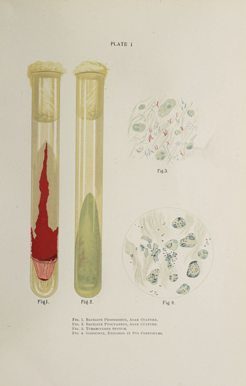 —-r—■ PLATE 1 Fig. 1. Bacillus Prodigiosus, Agar Culture. Fig. 2. Bacillus Pyocyaneus, Agar Culture. Fig. 3. Tuberculous Sputum. Fig. 4. Conococci, Enclosed in Pus Corpuscles.