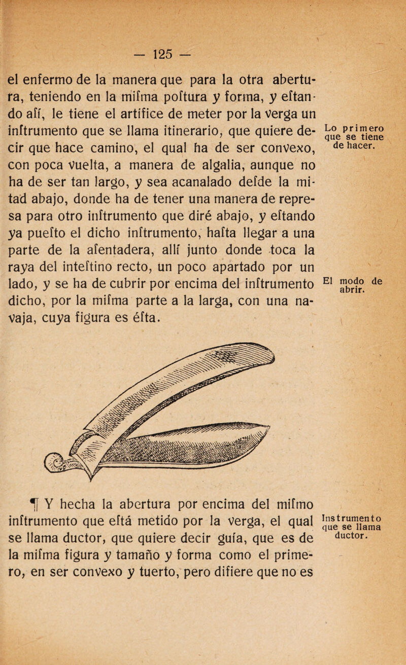 el enfermo de la manera que para la otra abertu¬ ra, teniendo en la mifma poftura y forma, y eítan- do afí, le tiene el artífice de meter por la verga un inftrumento que se llama itinerario, que quiere de¬ cir que hace camino, el qual ha de ser convexo, con poca vuelta, a manera de algalia, aunque no ha de ser tan largo, y sea acanalado defde la mi¬ tad abajo, donde ha de tener una manera de repre¬ sa para otro inftrumento que diré abajo, y eftando ya puefto el dicho inftrumento, haíta llegar a una parte de la afentadera, allí junto donde toca la raya del inteftino recto, un poco apartado por un lado, y se ha de cubrir por encima del inftrumento dicho, por la mifma parte a la larga, con una na¬ vaja, cuya figura es éfta. 1f Y hecha la abertura por encima del miímo inftrumento que eftá metido por la verga, el qual se llama ductor, que quiere decir guía, que es de la mifma figura y tamaño y forma como el prime¬ ro, en ser convexo y tuerto, pero difiere que no es Lo primero que se tiene de hacer. El modo de abrir. Instrumento que se llama ductor.