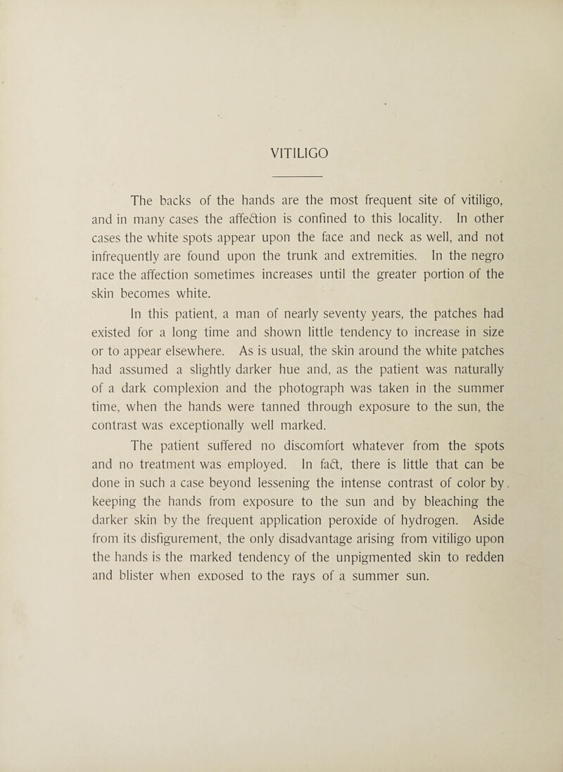 The backs of the hands are the most frequent site of vitiligo, and in many cases the affection is confined to this locality. In other cases the white spots appear upon the face and neck as well, and not infrequently are found upon the trunk and extremities. In the negro race the affection sometimes increases until the greater portion of the skin becomes white. In this patient, a man of nearly seventy years, the patches had existed for a long time and shown little tendency to increase in size or to appear elsewhere. As is usual, the skin around the white patches had assumed a slightly darker hue and, as the patient was naturally of a dark complexion and the photograph was taken in the summer time, when the hands were tanned through exposure to the sun, the contrast was exceptionally well marked. The patient suffered no discomfort whatever from the spots and no treatment was employed. In faft, there is little that can be done in such a case beyond lessening the intense contrast of color by keeping the hands from exposure to the sun and by bleaching the darker skin by the frequent application peroxide of hydrogen. Aside from its disfigurement, the only disadvantage arising from vitiligo upon the hands is the marked tendency of the unpigmented skin to redden and blister when exposed to the rays of a summer sun.