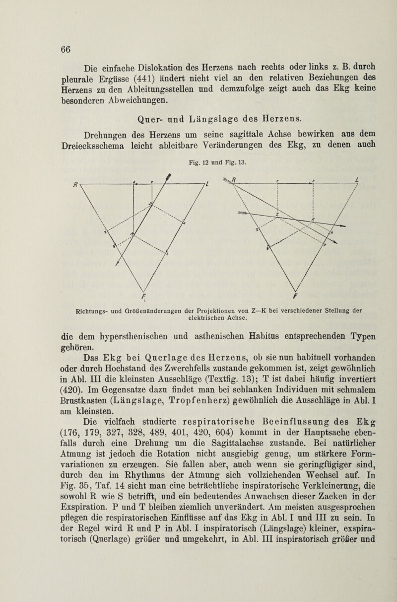 Die einfache Dislokation des Herzens nach rechts oder links z. B. durch pleurale Ergüsse (441) ändert nicht viel an den relativen Beziehungen des Herzens zu den Ableitungsstellen und demzufolge zeigt auch das Ekg keine besonderen Abweichungen. Quer- und Längslage des Herzens. Richtungs- und Größenänderungen der Projektionen von Z—K bei verschiedener Stellung der elektrischen Achse. die dem hypersthenischen und asthenischen Habitus entsprechenden Typen gehören. Das Ekg bei Querlage des Herzens, ob sie nun habituell vorhanden oder durch Hochstand des Zwerchfells zustande gekommen ist, zeigt gewöhnlich in Abi. III die kleinsten Ausschläge (Textfig. 13); T ist dabei häufig invertiert (420). Im Gegensätze dazu findet man bei schlanken Individuen mit schmalem Brustkasten (Längslage, Tropfenherz) gewöhnlich die Ausschläge in Abi. I am kleinsten. Die vielfach studierte respiratorische Beeinflussung des Ekg (176, 179, 327, 328, 489, 401, 420, 604) kommt in der Hauptsache eben¬ falls durch eine Drehung um die Sagittalachse zustande. Bei natürlicher Atmung ist jedoch die Rotation nicht ausgiebig genug, um stärkere Form¬ variationen zu erzeugen. Sie fallen aber, auch wenn sie geringfügiger sind, durch den im Rhythmus der Atmung sich vollziehenden Wechsel auf. In Fig. 35, Taf. 14 sieht man eine beträchtliche inspiratorische Verkleinerung, die sowohl R wie S betrifft, und ein bedeutendes Anwachsen dieser Zacken in der Exspiration. P und T bleiben ziemlich unverändert. Am meisten ausgesprochen pflegen die respiratorischen Einflüsse auf das Ekg in Abi. I und III zu sein. In der Regel wird R und P in Abi. I inspiratorisch (Längslage) kleiner, exspira- torisch (Querlage) größer und umgekehrt, in Abi. III inspiratorisch größer und