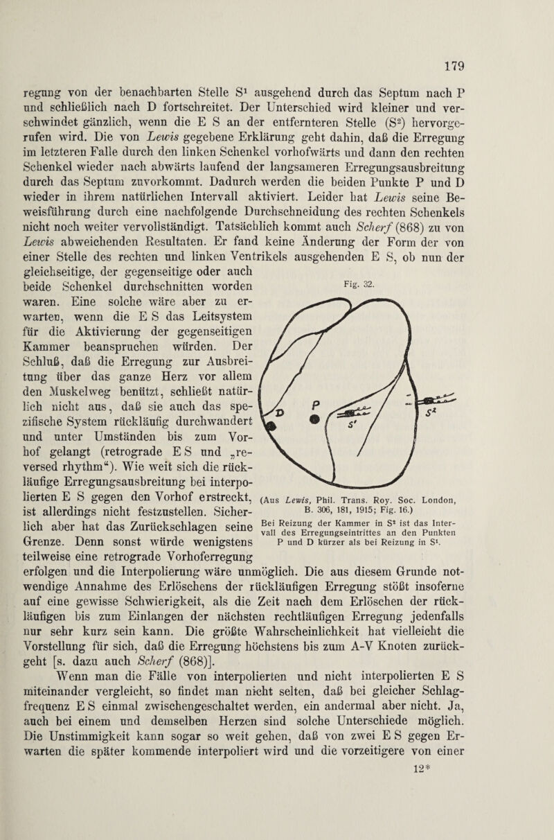Fig. 32. regung von der benachbarten Stelle S1 ansgehend durch das Septum nach P und schließlich nach D fortschreitet. Der Unterschied wird kleiner und ver¬ schwindet gänzlich, wenn die E S an der entfernteren Stelle (S2) hervorge¬ rufen wird. Die von Lewis gegebene Erklärung geht dahin, daß die Erregung im letzteren Falle durch den linken Schenkel vorhofwärts und dann den rechten Schenkel wieder nach abwärts laufend der langsameren Erregungsausbreitung durch das Septum zuvorkommt. Dadurch werden die beiden Punkte P und D wieder in ihrem natürlichen Intervall aktiviert. Leider hat Lewis seine Be¬ weisführung durch eine nachfolgende Durchschneidung des rechten Schenkels nicht noch weiter vervollständigt. Tatsächlich kommt auch Scherf (868) zu von Lewis abweichenden Resultaten. Er fand keine Änderung der Form der von einer Stelle des rechten und linken Ventrikels ausgehenden E S, ob nun der gleichseitige, der gegenseitige oder auch beide Schenkel durchschnitten worden waren. Eine solche wäre aber zu er¬ warten, wenn die E S das Leitsystem für die Aktivierung der gegenseitigen Kammer beanspruchen würden. Der Schluß, daß die Erregung zur Ausbrei¬ tung über das ganze Herz vor allem den Muskel weg benützt, schließt natür¬ lich nicht aus, daß sie auch das spe¬ zifische System rückläufig durchwandert und unter Umständen bis zum Vor¬ hof gelangt (retrograde E S und „re- versed rhythm“). Wie weit sich die rück¬ läufige Erregungsausbreitung bei interpo¬ lierten E S gegen den Voihof erstreckt, (Aus Lewis, Phil. Trans. Roy. Soc. London, ist allerdings nicht festzustellen. Sicher- B 306> 181> 1915» Fi§-16-) lieh aber hat das Zurückschlagen seine Be* Reizu£g der in s* iat daa InJf- ö vall des Erregungseintrittes an den Punkten Grenze. Denn sonst würde wenigstens P und D kürzer als bei Reizung in s*. teilweise eine retrograde Vorhoferregung erfolgen und die Interpolierung wäre unmöglich. Die aus diesem Grunde not¬ wendige Annahme des Erlöschens der rückläufigen Erregung stößt insoferne auf eine gewisse Schwierigkeit, als die Zeit nach dem Erlöschen der rück¬ läufigen bis zum Einlangen der nächsten rechtläufigen Erregung jedenfalls nur sehr kurz sein kann. Die größte Wahrscheinlichkeit hat vielleicht die Vorstellung für sich, daß die Erregung höchstens bis zum A-V Knoten zurück¬ geht [s. dazu auch Scherf (868)]. Wenn man die Fälle von interpolierten und nicht interpolierten E S miteinander vergleicht, so findet man nicht selten, daß bei gleicher Schlag¬ frequenz E S einmal zwischengeschaltet werden, ein andermal aber nicht. Ja, auch bei einem und demselben Herzen sind solche Unterschiede möglich. Die Unstimmigkeit kann sogar so weit gehen, daß von zwei E S gegen Er¬ warten die später kommende interpoliert wird und die vorzeitigere von einer 12*