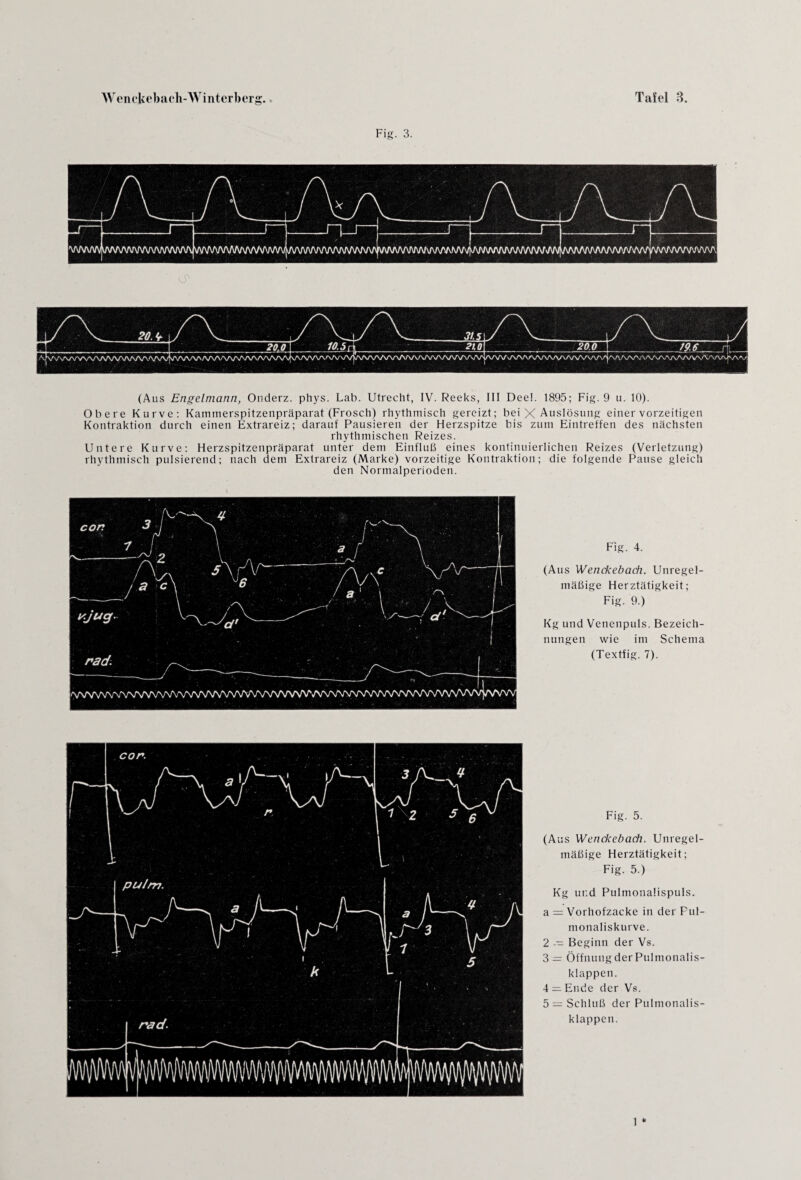 (Aus Engelmann, Onderz. phys. Lab. Utrecht, IV. Reeks, III Deel. 1895; Fig. 9 u. 10). Obere Kurve: Kammerspitzenpräparat (Frosch) rhythmisch gereizt; bei X Auslösung einer vorzeitigen Kontraktion durch einen Extrareiz; darauf Pausieren der Herzspitze bis zum Eintreffen des nächsten rhythmischen Reizes. Untere Kurve: Herzspitzenpräparat unter dem Einfluß eines kontinuierlichen Reizes (Verletzung) rhythmisch pulsierend; nach dem Extrareiz (Marke) vorzeitige Kontraktion; die folgende Pause gleich den Normalperioden. Fig. 4. (Aus Wenckebach. Unregel¬ mäßige Herztätigkeit; Fig. 9.) Kg und Venenpuls. Bezeich¬ nungen wie im Schema (Textfig. 7). Fig. 5. (Aus Wenckebach. Unregel¬ mäßige Herztätigkeit; Fig. 5.) Kg ur.d Pulmonalispuls. a = Vorhofzacke in der Ful- monaliskurve. 2 -- Beginn der Vs. 3 = Öffnung der Pulmonalis- klappen. 4 — Ende der Vs. 5 — Schluß der Pulmonalis- klappen. 1 *