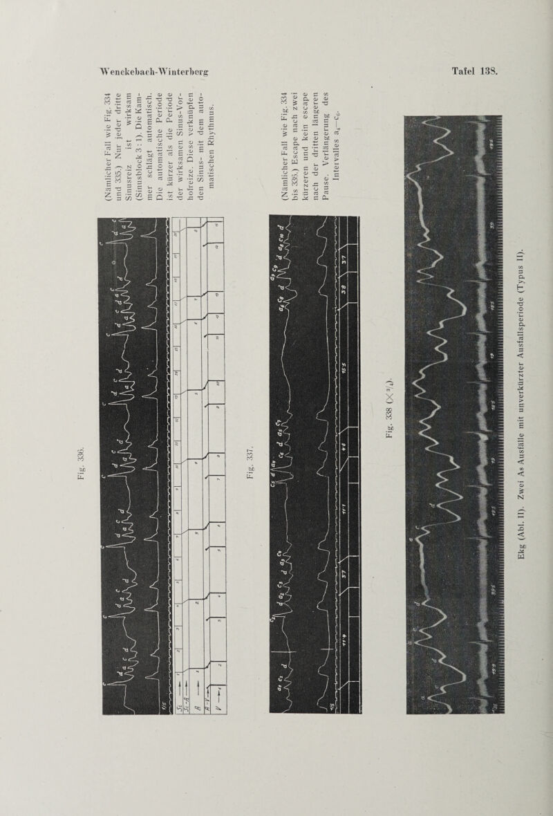 (Nämlicher Fall wie Fig. 334 und 335.) Nur jeder dritte Sinusreiz ist wirksam 5 >—< •5 tG 33 CO Ui o bi 2 +-< o3 r als 33 o3 X X <D Q 1 X <D r~* 03 Um <D 03 CJ X W und 'S :o3 33 > o r'j X u= CJ X O 03 <D N Ui CD* N r—1 cZ CJ X 'S .CJ CD CO 33 •— <D dei <D G mer <d V <D G :o3 CO N SZ CJ X G cZ Q X 33 TT O CD T3 z X 5 5 Ui 03 G 03 CU <D >