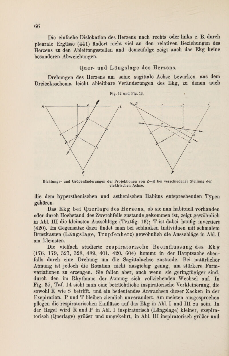Die einfache Dislokation des Herzens nach rechts oder links z. B. durch pleurale Ergüsse (441) ändert nicht viel an den relativen Beziehungen des Herzens zu den Ableitungsstellen und demzufolge zeigt auch das Ekg keine besonderen Abweichungen. Quer- und Längslage des Herzens. Richtungs- und Größenänderungen der Projektionen von Z—K bei verschiedener Stellung der elektrischen Achse. die dem hypersthenischen und asthenischen Habitus entsprechenden Typen gehören. Das Ekg bei Querlage des Herzens, ob sie nun habituell vorhanden oder durch Hochstand des Zwerchfells zustande gekommen ist, zeigt gewöhnlich in Abi. III die kleinsten Ausschläge (Textfig. 13); T ist dabei häufig invertiert (420). Im Gegensätze dazu findet man bei schlanken Individuen mit schmalem Brustkasten (Längslage, Tropfenherz) gewöhnlich die Ausschläge in Abi. I am kleinsten. Die vielfach studierte respiratorische Beeinflussung des Ekg (176, 179, 327, 328, 489, 401, 420, 604) kommt in der Hauptsache eben¬ falls durch eine Drehung um die Sagittalachse zustande. Bei natürlicher Atmung ist jedoch die Rotation nicht ausgiebig genug, um stärkere Form¬ variationen zu erzeugen. Sie fallen aber, auch wenn sie geringfügiger sind, durch den im Rhythmus der Atmung sich vollziehenden Wechsel auf. In Fig. 35, Taf. 14 sieht man eine beträchtliche inspiratorische Verkleinerung, die sowohl R wie S betrifft, und ein bedeutendes Anwachsen dieser Zacken in der Exspiration. P und T bleiben ziemlich unverändert. Am meisten ausgesprochen pflegen die respiratorischen Einflüsse auf das Ekg in Abi. I und III zu sein. In der Regel wird R und P in Abi. I inspiratorisch (Längslage) kleiner, exspira- torisch (Querlage) größer und umgekehrt, in Abi. III inspiratorisch größer und