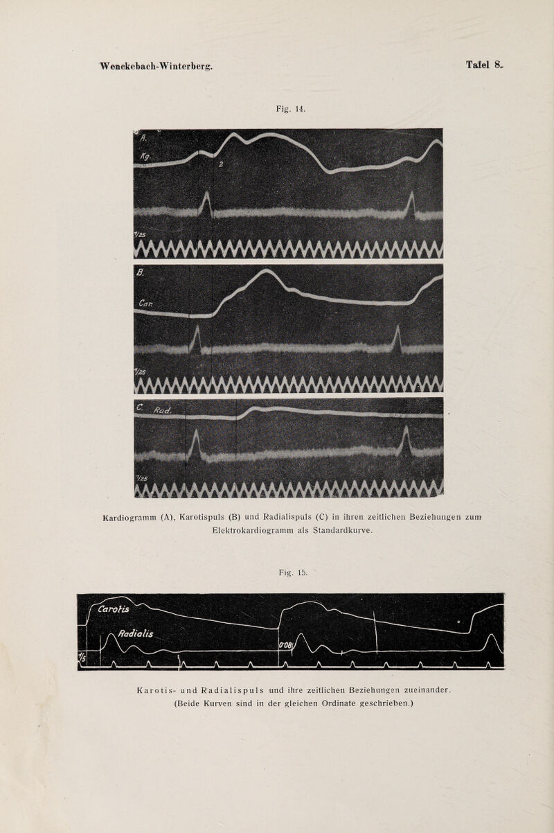 Fig. 14. Mi aVaYäYä A 4 äYä A A kkäAAkk kMÜSLA4 Kardiogramm (A), Karotispuls (B) und Radialispuls (C) in ihren zeitlichen Beziehungen zum Elektrokardiogramm als Standardkurve. Fig. 15. Karotis- und Radialispuls und ihre zeitlichen Beziehungen zueinander. (Beide Kurven sind in der gleichen Ordinate geschrieben.)