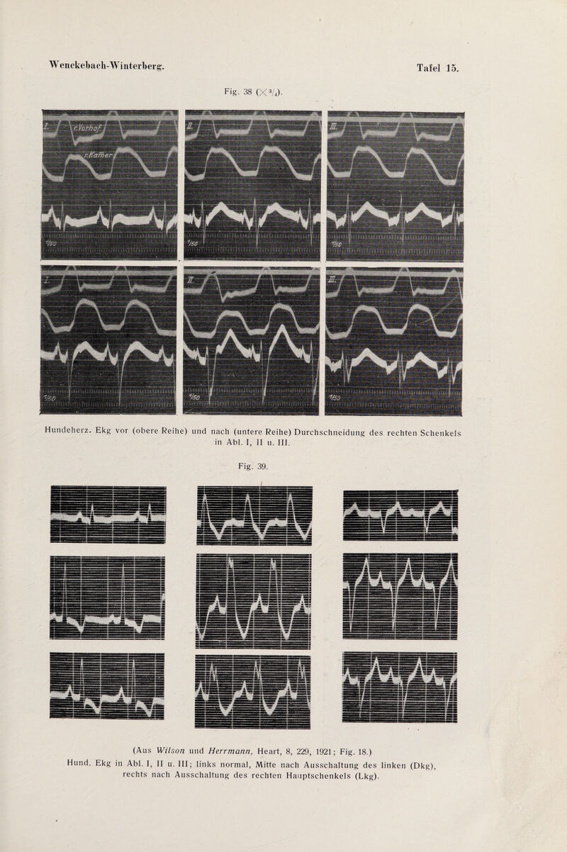 Fig. 38 (X3/4>- Hundeherz. Ekg voi (obere Reihe) und nach (untere Reihe) Durchschneidung des rechten Schenkels in Abi. I, II u. III. Fig. 39. (Aus Wilson und Herrmann, Heart, 8, 229, 1921; Fig. 18.) Hund. Ekg in Abi. I, II u. III; links normal, Mitte nach Ausschaltung des linken (Dkg), rechts nach Ausschaltung des rechten Hauptschenkels (Lkg).