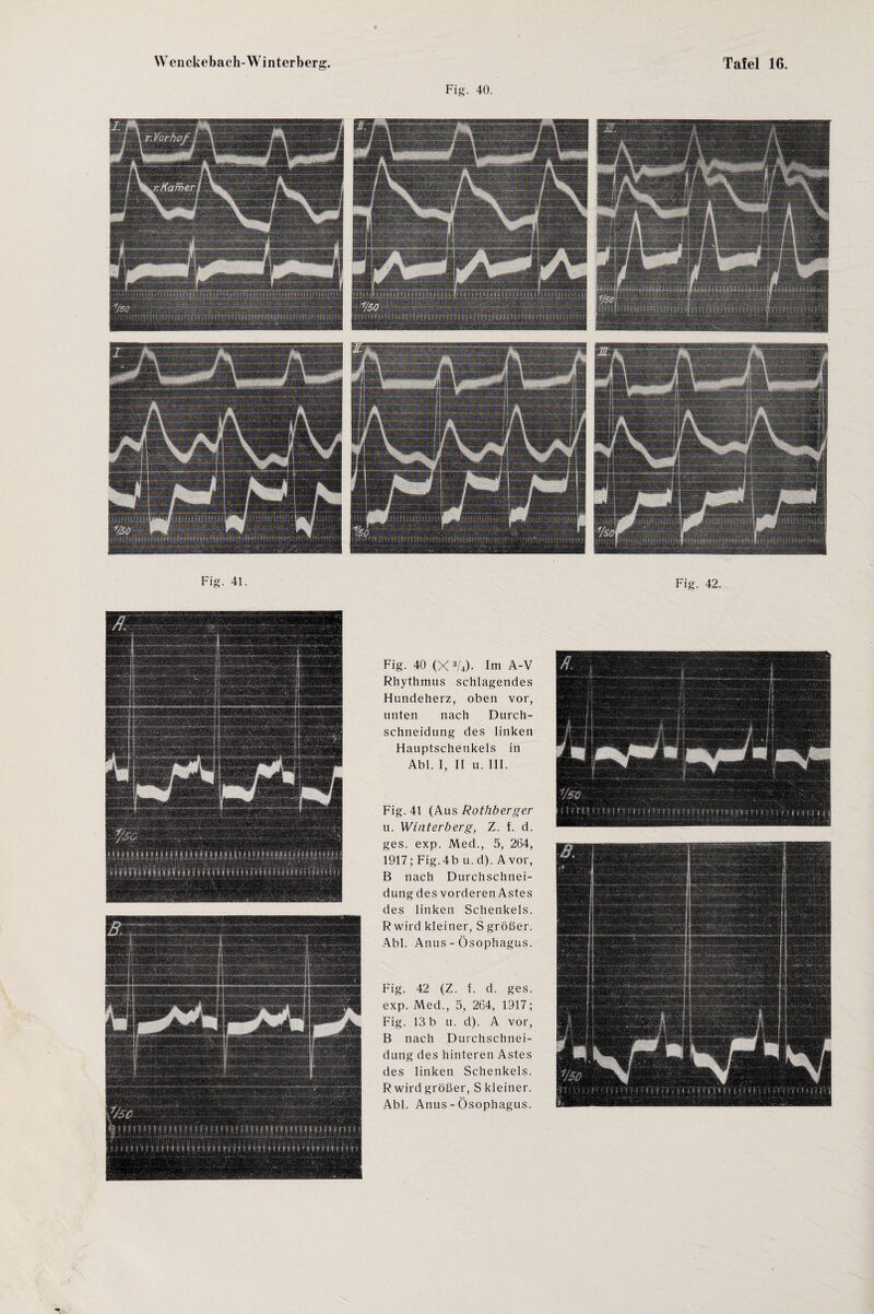 Fig. 40. Fig. 41. Fig. 42. Fig. 40 (X 3L). Im A-V Rhythmus schlagendes Flundeherz, oben vor, unten nach Durch¬ schneidung des linken Hauptschenkels in Abi. I, II u. III. Fig. 41 (Aus Rothberger u. Winterberg, Z. f. d. ges. exp. Med., 5, 264, 1917 ; Fig. 4b u. d). A vor, B nach Durchschnei¬ dung des vorderen Astes des linken Schenkels. R wird kleiner, S größer. Abi. Anus - Ösophagus. Fig. 42 (Z. I. d. ges. exp. Med., 5, 264, 1917; Fig. 13 b u. d). A vor, B nach Durchschnei¬ dung des hinteren Astes des linken Schenkels. R wird größer, S kleiner. Abi. Anus - Ösophagus.