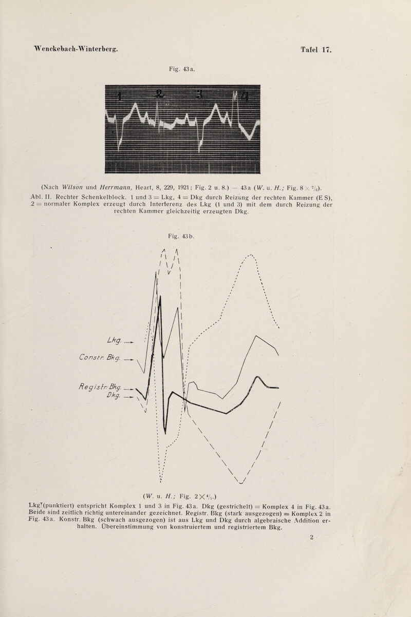 (Nach Wilson und Herrmann, Heart, 8, 229, 1921; Fig. 2 u. 8.) — 43a (VF. u. H.; Fig. 8 X7/e)- Abi. II. Rechter Schenkelblock. 1 und 3 = Lkg, 4 = Dkg durch Reizung der rechten Kammer (E S), 2 — normaler Komplex erzeugt durch Interferenz des Lkg (1 und 3) mit dem durch Reizung der rechten Kammer gleichzeitig erzeugten Dkg. Fig. 43b. (VF. u. H.; Fig. 2XV.v) LkgT(punktiert) entspricht Komplex 1 und 3 in Fig. 43 a. Dkg (gestrichelt) = Komplex 4 in Fig. 43a. Beide sind zeitlich richtig untereinander gezeichnet. Registr. Bkg (stark ausgezogen) = Komplex 2 in Fig. 43a. Konstr. Bkg (schwach ausgezogen) ist aus Lkg und Dkg durch algebraische Addition er¬ halten. Übereinstimmung von konstruiertem und registriertem Bkg. 2