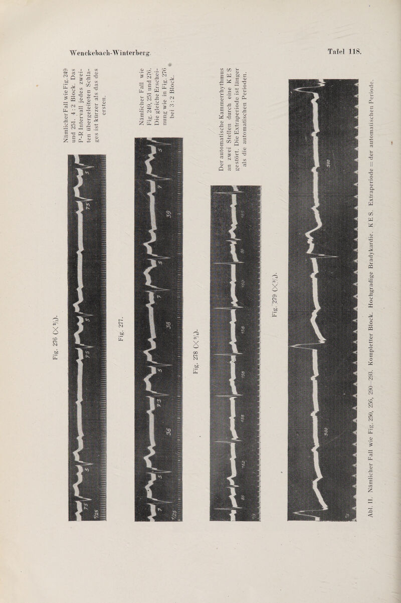 Abi. II. Nämlicher Fall wie Fig. 250, 256, 290—293. Kompletter Block. Hochgradige Bradykardie. KES. Extraperiode = der automatischen Periode.