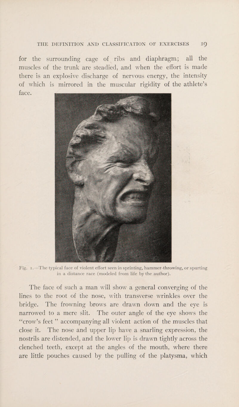 for the surrounding cage of ribs and diaphragm; all the muscles of the trunk are steadied, and when the effort is made there is an explosive discharge of nervous energy, the intensity of which is mirrored in the muscular rigidity of the athlete’s Fig. i.—The typical face of violent effort seen in sprinting, hammer-throwing, or spurting in a distance race (modeled from life by the author). The face of such a man will show a general converging of the lines to the root of the nose, with transverse wrinkles over the bridge. The frowning brows are drawn down and the eye is narrowed to a mere slit. The outer angle of the eye shows the “crow’s feet ” accompanying all violent action of the muscles that close it. The nose and upper lip have a snarling expression, the nostrils are distended, and the lower lip is drawn tightly across the clenched teeth, except at the angles of the mouth, where there are little pouches caused by the pulling of the platysma, which