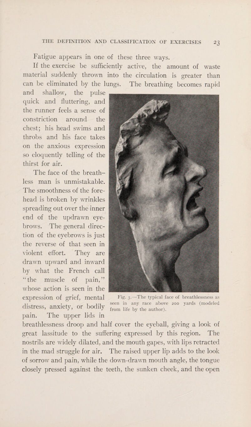 Fatigue appears in one of these three ways. If the exercise be sufficiently active, the amount of waste material suddenly thrown into the circulation is greater than can be eliminated by the lungs. The breathing becomes rapid and shallow, the pulse quick and fluttering, and the runner feels a sense of constriction around the chest; his head swims and throbs and his face takes on the anxious expression so eloquently telling of the thirst for air. The face of the breath¬ less man is unmistakable. The smoothness of the fore¬ head is broken by wrinkles spreading out over the inner end of the updrawn eye¬ brows. The general direc¬ tion of the eyebrows is just the reverse of that seen in violent effort. They are drawn upward and inward by what the French call “the muscle of pain,” whose action is seen in the expression of grief, mental Fig. 3-—The typical face of breathlessness as . . i seen in any race above 200 yards (modeled distress, anxiety, or bodily from life by the author) pain. The upper lids in breathlessness droop and half cover the eyeball, giving a look of great lassitude to the suffering expressed by this region. The nostrils are widely dilated, and the mouth gapes, with lips retracted in the mad struggle for air. The raised upper lip adds to the look of sorrow and pain, while the down-drawn mouth angle, the tongue closely pressed against the teeth, the sunken cheek, and the open