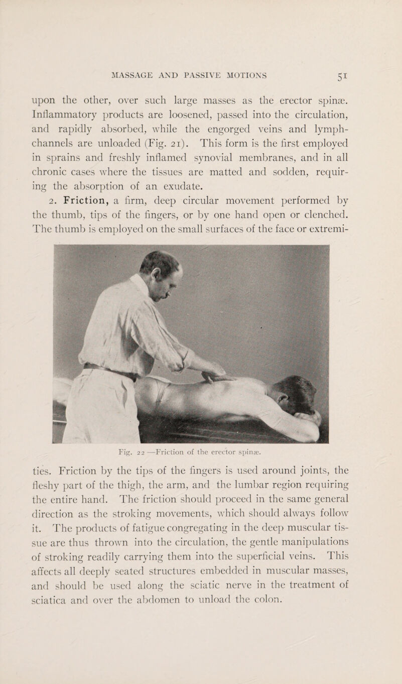 upon the other, over such large masses as the erector spinae. Inflammatory products are loosened, passed into the circulation, and rapidly absorbed, while the engorged veins and lymph- channels are unloaded (Fig. 21). This form is the first employed in sprains and freshly inflamed synovial membranes, and in all chronic cases where the tissues are matted and sodden, requir¬ ing the absorption of an exudate. 2. Friction, a firm, deep circular movement performed by the thumb, tips of the fingers, or by one hand open or clenched. The thumb is employed on the small surfaces of the face or extremi- Fig. 22 —Friction of the erector spinae. ties. Friction by the tips of the fingers is used around joints, the fleshy part of the thigh, the arm, and the lumbar region requiring the entire hand. The friction should proceed in the same general direction as the stroking movements, which should always follow it. The products of fatigue congregating in the deep muscular tis¬ sue are thus thrown into the circulation, the gentle manipulations of stroking readily carrying them into the superficial veins. This affects all deeply seated structures embedded in muscular masses, and should be used along the sciatic nerve in the treatment of sciatica and over the abdomen to unload the colon.