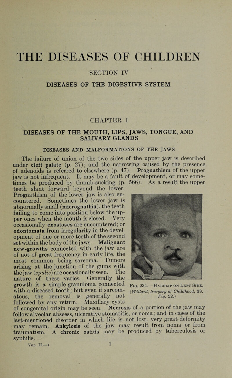 THE DISEASES OF CHILDREN SECTION IV DISEASES OF THE DIGESTIVE SYSTEM CHAPTER I DISEASES OF THE MOUTH, LIPS, JAWS, TONGUE, AND SALIVARY GLANDS DISEASES AND MALFORMATIONS OF THE JAWS The failure of union of the two sides of the upper jaw is described under cleft palate (p. 27); and the narrowing caused by the presence of adenoids is referred to elsewhere (p. 47). Prognathism of the upper jaw is not infrequent. It may be a fault of development, or may some¬ times be produced by thumb-sucking (p. 566). As a result the upper teeth slant forward beyond the lower. Prognathism of the lower jaw is also en¬ countered. Sometimes the lower jaw is abnormally small (micrognathia), the teeth failing to come into position below the up¬ per ones when the mouth is closed. Very occasionally exostoses are encountered; or odontomata from irregularity in the devel¬ opment of one or more teeth of the second set within the body of the jaws. Malignant new-growths connected with the jaw are of not of great frequency in early life, the most common being sarcoma. Tumors arising at the junction of the gums with the jaw (epulis) are occasionally seen. The nature of these varies. Generally the growth is a simple granuloma connected Fig 234—Harelip on Left Side. with a diseased tooth; but even if sarcom- ^Willard, Surgery of Childhood, 38, atous, the removal is generally not Fig. 22.) followed by any return. Maxillary cysts of congenital origin may be seen. Necrosis of a portion of the jaw may follow alveolar abscess, ulcerative stomatitis, or noma; and in cases of the last-mentioned disorder in which life is not lost, very great deformity may remain. Ankylosis of the jaw may result from noma or from traumatism. A chronic ostitis may be produced by tuberculosis or syphilis. VOL. 11—1
