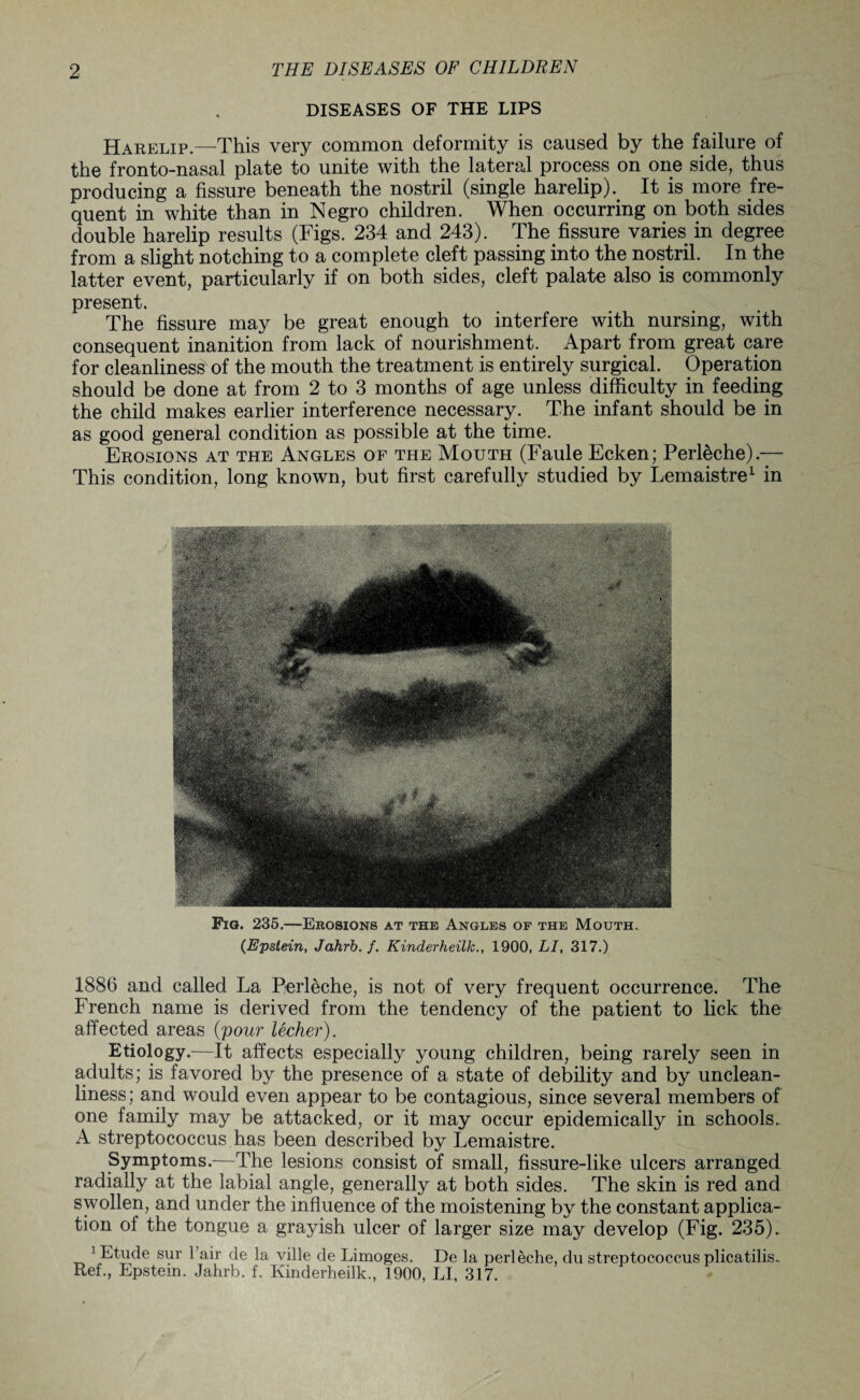 DISEASES OF THE LIPS Harelip.—This very common deformity is caused by the failure of the fronto-nasal plate to unite with the lateral process on one side, thus producing a fissure beneath the nostril (single harelip). It is more fre¬ quent in white than in Negro children. When occurring on both sides double harelip results (Figs. 234 and 243). The fissure varies in degree from a slight notching to a complete cleft passing into the nostril. In the latter event, particularly if on both sides, cleft palate also is commonly present. The fissure may be great enough to interfere with nursing, with consequent inanition from lack of nourishment. Apart from great care for cleanliness of the mouth the treatment is entirely surgical. Operation should be done at from 2 to 3 months of age unless difficulty in feeding the child makes earlier interference necessary. The infant should be in as good general condition as possible at the time. Erosions at the Angles of the Mouth (Faule Ecken; Perleche).— This condition, long known, but first carefully studied by Lemaistre1 in Fig. 235.—Erosions at the Angles of the Mouth. (Epstein, Jahrb.f. Kinderheilk., 1900, LI, 317.) 1886 and called La Perleche, is not of very frequent occurrence. The French name is derived from the tendency of the patient to lick the affected areas (pour lecher). Etiology.—It affects especially young children, being rarely seen in adults; is favored by the presence of a state of debility and by unclean¬ liness; and would even appear to be contagious, since several members of one family may be attacked, or it may occur epidemically in schools.. A streptococcus has been described by Lemaistre. Symptoms.—The lesions consist of small, fissure-like ulcers arranged radially at the labial angle, generally at both sides. The skin is red and swollen, and under the influence of the moistening by the constant applica¬ tion of the tongue a grayish ulcer of larger size may develop (Fig. 235). 1 Etude sur Fair de la ville de Limoges. De la perleche, du streptococcus plicatilis- Ref., Epstein. Jahrb. f. Kinderheilk., 1900, LI, 317.