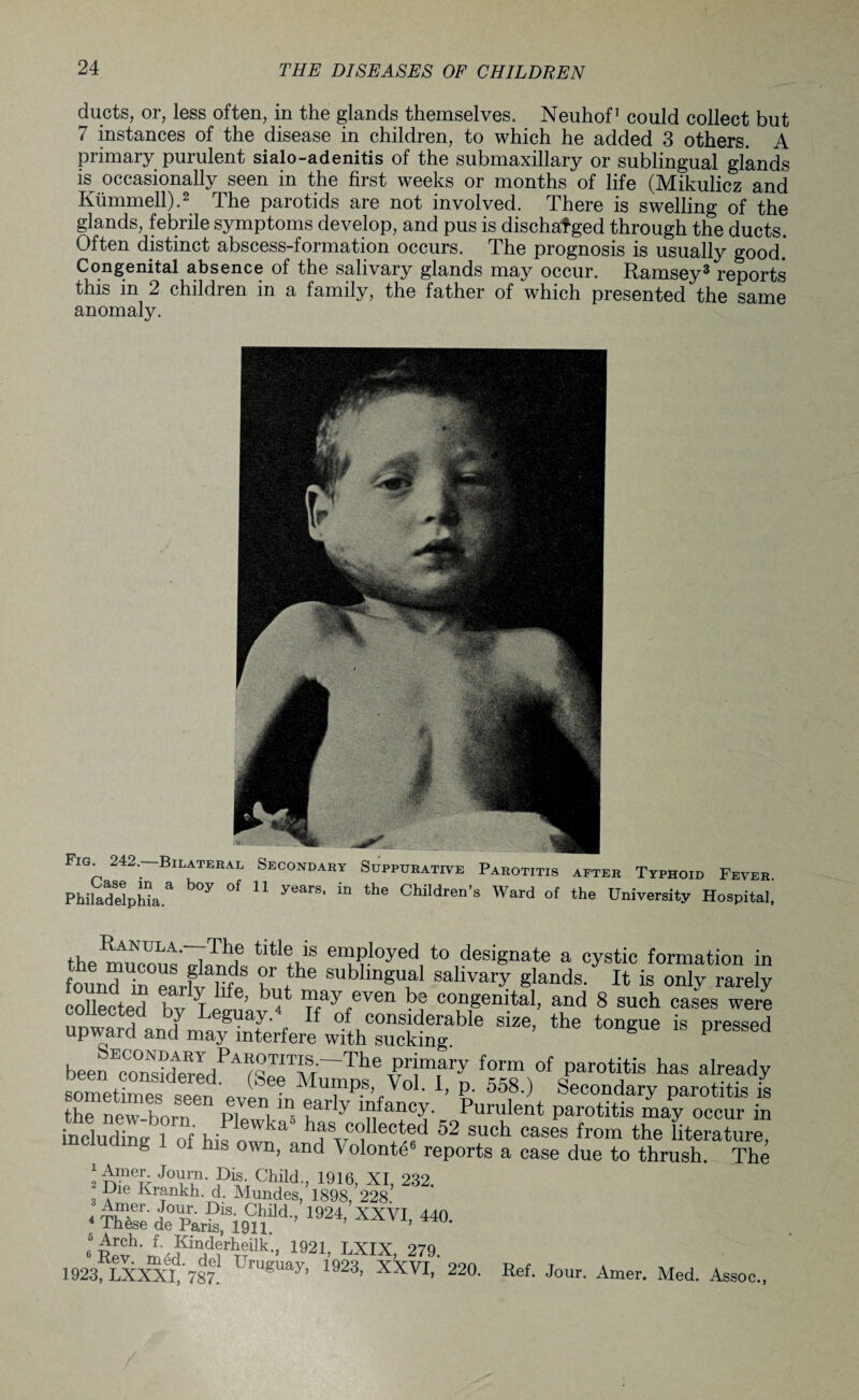 ducts, or, less often, in the glands themselves. Neuhof1 could collect but 7 instances of the disease in children, to which he added 3 others. A primary purulent sialo-adenitis of the submaxillary or sublingual glands is^ occasionally seen in the first weeks or months of life (Mikulicz and Kummell).2 The parotids are not involved. There is swelling of the glands, febrile symptoms develop, and pus is discharged through the ducts. Often distinct abscess-formation occurs. The prognosis is usually good.' Congenital absence of the salivary glands may occur. Ramsey3 reports this in 2 children in a family, the father of which presented the same anomaly. Fig* 242\ Bilateral Secondary Suppurative Parotitis after Typhoid Feve Philadelphia * b°y °f 11 yearSt m the Children’s Ward of the University Hospiti tbA^fULA’ iThf tltle,ls employed to designate a cystic formation in found to earfv^fc h subIm§u^ salary glands. It is only rarely collected hv^T b 4* “ay,even b? congenital, and 8 such cases were ■ 1 ftoay. If of considerable size, the tongue is Dressed upward and may interfere with sucking. g P beenEcZltoeBrIdPA^JpTM~The ,?Tnfry form of Parotitis has already sometimes seen Mu™P.s, Vol. 1, p. 558.) Secondary parotitis is the new-horn pu , , ?arIy “fancy- Purulent parotitis may occur in including 1 of his nW a las collected 52 such cases from the literature, g - of his own, and \ olonte6 reports a case due to thrush. The ^ A mpr -Tnilm T W. -I r\ 1 rk . - . 2 J<T?' P-Chlld^ 1916> XI, 232. Die Krankh. d. Mundes, 1898, 228 TEde0raJtoSi9CnM-’ 1924’ xxVl>440- ‘Upvh'i'T“id?rT?ilk-- 1921' LXIX> 279. 1923 LXXXI%87 UgUay’ 1923’ XXVI' 220 Ref. Jour. Amer. Med. Assoc.,