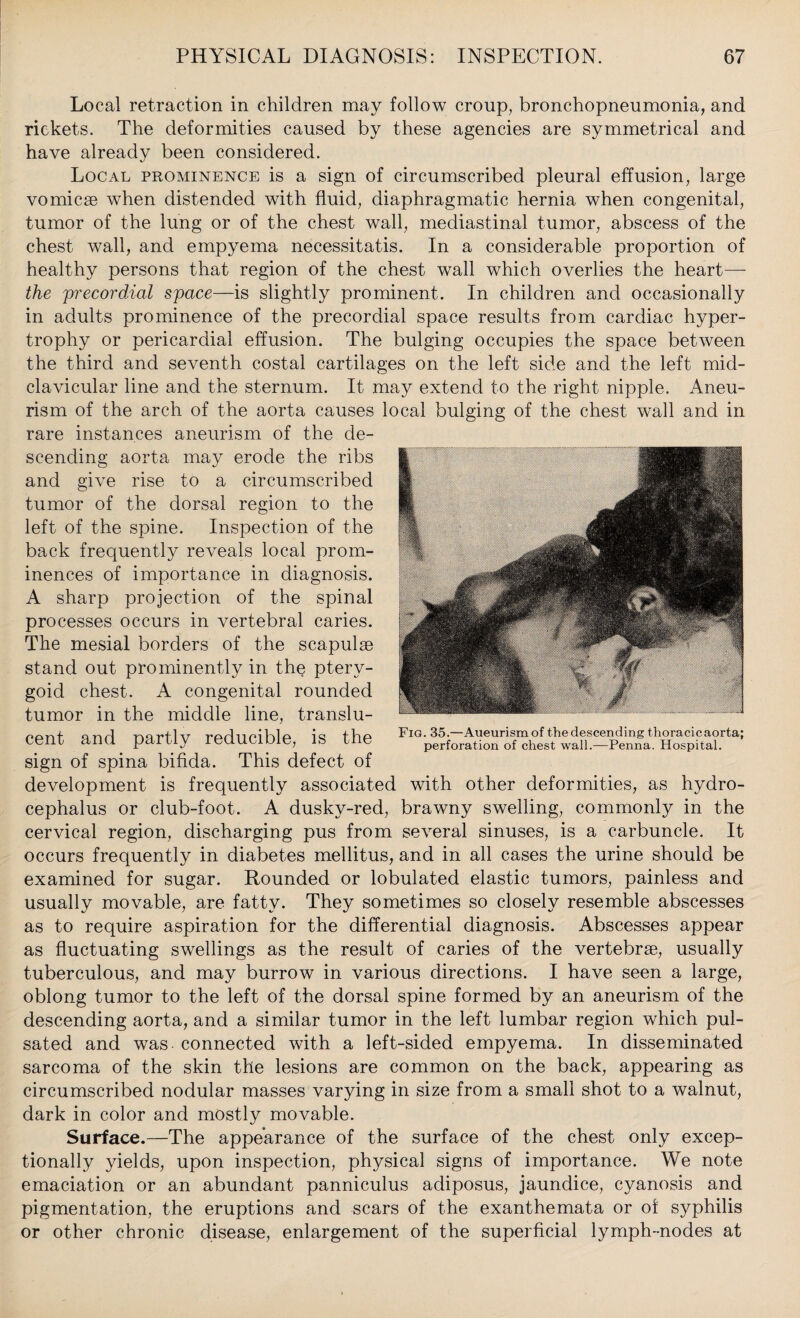 Local retraction in children may follow croup, bronchopneumonia, and rickets. The deformities caused by these agencies are symmetrical and have already been considered. Local prominence is a sign of circumscribed pleural effusion, large vomicae when distended with fluid, diaphragmatic hernia when congenital, tumor of the lung or of the chest wall, mediastinal tumor, abscess of the chest wall, and empyema necessitatis. In a considerable proportion of healthy persons that region of the chest wall which overlies the heart— the precordial space—is slightly prominent. In children and occasionally in adults prominence of the precordial space results from cardiac hyper¬ trophy or pericardial effusion. The bulging occupies the space between the third and seventh costal cartilages on the left side and the left mid- clavicular line and the sternum. It may extend to the right nipple. Aneu¬ rism of the arch of the aorta causes local bulging of the chest wall and in rare instances aneurism of the de¬ scending aorta may erode the ribs and give rise to a circumscribed tumor of the dorsal region to the left of the spine. Inspection of the back frequently reveals local prom¬ inences of importance in diagnosis. A sharp projection of the spinal processes occurs in vertebral caries. The mesial borders of the scapulae stand out prominently in the ptery¬ goid chest. A congenital rounded tumor in the middle line, translu¬ cent and partly reducible, is the sign of spina bifida. This defect of development is frequently associated with other deformities, as hydro¬ cephalus or club-foot. A dusky-red, brawny swelling, commonly in the cervical region, discharging pus from several sinuses, is a carbuncle. It occurs frequently in diabetes mellitus, and in all cases the urine should be examined for sugar. Rounded or lobulated elastic tumors, painless and usually movable, are fatty. They sometimes so closely resemble abscesses as to require aspiration for the differential diagnosis. Abscesses appear as fluctuating swellings as the result of caries of the vertebrae, usually tuberculous, and may burrow in various directions. I have seen a large, oblong tumor to the left of the dorsal spine formed by an aneurism of the descending aorta, and a similar tumor in the left lumbar region which pul¬ sated and was connected with a left-sided empyema. In disseminated sarcoma of the skin the lesions are common on the back, appearing as circumscribed nodular masses varying in size from a small shot to a walnut, dark in color and mostly movable. Surface.—The appearance of the surface of the chest only excep¬ tionally yields, upon inspection, physical signs of importance. We note emaciation or an abundant panniculus adiposus, jaundice, cyanosis and pigmentation, the eruptions and scars of the exanthemata or of syphilis or other chronic disease, enlargement of the superficial lymph-nodes at