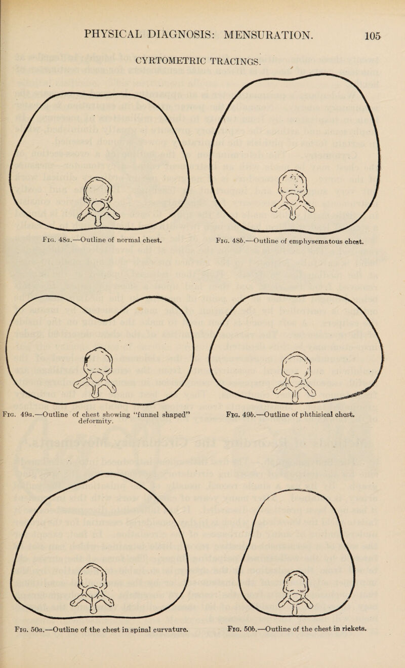 CYRTOMETRIC TRACINGS. / Fig. 486.—Outline of emphysematous chest. deformity.