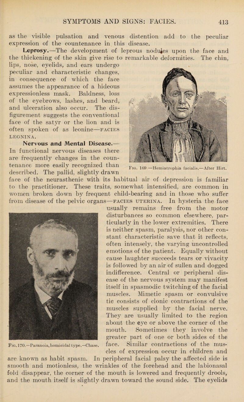 as the visible pulsation and venous distention add to the peculiar expression of the countenance in this disease. Leprosy.—The development of leprous nodules upon the face and the thickening of the skin give rise to remarkable deformities. The chin, lips, nose, eyelids, and ears undergo peculiar and characteristic changes, in consequence of which the face assumes the appearance of a hideous expressionless mask. Baldness, loss of the eyebrows, lashes, and beard, and ulceration also occur. The dis¬ figurement suggests the conventional face of the satyr or the lion and is often spoken of as leonine—facies LEONINA. Nervous and Mental Disease.— In functional nervous diseases there are frequently changes in the coun¬ tenance more easily recognized than described. The pallid, slightly drawn face of the neurasthenic with its habitual air of depression is familiar to the practitioner. These traits, somewhat intensified, are common in women broken down by frequent child-bearing and in those who suffer from disease of the pelvic organs—facies uterina. In hysteria the face usually remains free from the motor disturbances so common elsewhere, par¬ ticularly in the lower extremities. There is neither spasm, paralysis, nor other con¬ stant characteristic save that it reflects, often intensely, the varying uncontrolled emotions of the patient. Equally without cause laughter succeeds tears or vivacity is followed by an air of sullen and dogged indifference. Central or peripheral dis¬ ease of the nervous system may manifest itself in spasmodic twitching of the facial muscles. Mimetic spasm or convulsive tic consists of clonic contractions of the muscles supplied by the facial nerve. They are usually limited to the region about the eye or above the corner of the mouth. Sometimes they involve the greater part of one or both sides of the Fig. 170.—Paranoia,homicidal type.—Chase, face. Similar contractions of the mus* cles of expression occur in children and are known as habit spasm. In peripheral facial palsy the affected side is smooth and motionless, the wrinkles of the forehead and the labionasal fold disappear, the corner of the mouth is lowered and frequently drools, and the mouth itself is slightly drawn toward the sound side. The eyelids Fig. 169-—Hemiatrophia facialis.—After Hirt.