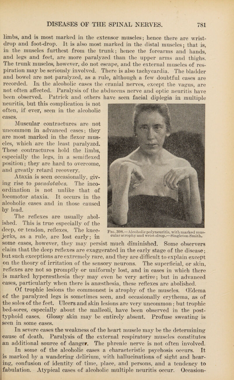 limbs, and is most marked in the extensor mnscles ; hence there are wrist¬ drop and foot-drop. It is also most marked in the distal muscles; that is, in the muscles furthest from the trunk; hence the forearms and hands, and legs and feet, are more paralyzed than the upper arms and thighs. The trunk muscles, however, do not escape, and the external muscles of res¬ piration may be seriously involved. There is also tachycardia. The bladder and bowel are not paralyzed, as a rule, although a few doubtful cases are recorded. In the alcoholic cases the cranial nerves, except the vagus, are not often affected. Paralysis of the abducens nerve and optic neuritis have been observed. Patrick and others have seen facial diplegia in multiple neuritis, but this complication is not often, if ever, seen in the alcoholic cases. Muscular contractures are not uncommon in advanced cases; they are most marked in the flexor mus¬ cles, which are the least paralyzed. These contractures hold the limbs, especially the legs, in a semi flexed position; they are hard to overcome, and greatly retard recovery. Ataxia is seen occasionally, giv¬ ing rise to pseudotabes. The inco¬ ordination is not unlike that of locomotor ataxia. It occurs in the alcoholic cases and in those caused by lead. The reflexes are usually abol¬ ished. This is true especially of the deep, or tendon, reflexes. The knee- jerks, as a rule, are lost early; in some eases, however, they may persist much diminished. Some observers claim that the deep reflexes are exaggerated in the early stage of the disease; but such exceptions are extremely rare, and they are difficult to explain except Fig. 398.—Alcoholic polyneuritis, with marked mus¬ cular atrophy and wrist-drop.—Singleton Smith. on the theory of irritation of the sensory neurons. The superficial, or skin, reflexes are not so promptly or uniformly lost, and in cases in which there is marked hyperesthesia they may even be very active; but in advanced cases, particularly when there is anesthesia, these reflexes are abolished. Of trophic lesions the commonest is atrophy of the muscles. (Edema of the paralyzed legs is sometimes seen, and occasionally erythema, as of the soles of the feet. Ulcers and skin lesions are very uncommon; but trophic bed-sores, especially about the malleoli, have been observed in the post¬ typhoid cases. Glossy skin may be entirely absent. Profuse sweating is seen in some cases. In severe cases the weakness of the heart muscle may be the determining cause of death. Paralysis of the external respiratory muscles constitutes an additional source of danger. The phrenic nerve is not often involved. In some of the alcoholic cases a characteristic psychosis occurs. It is marked by a wandering delirium, with hallucinations of sight and hear¬ ing, confusion of identity of time, place, and persons, and a tendency to fabulation. Atypical cases of alcoholic multiple neuritis occur. Occasion-
