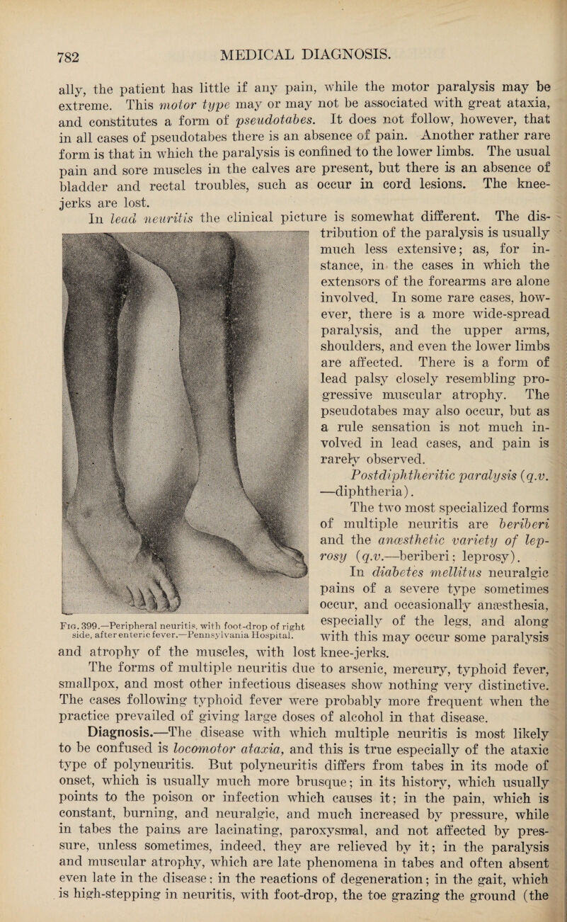 ally, the patient has little if any pain, while the motor paralysis may be extreme. This motor type may or may not be associated with great ataxia, and constitutes a form of pseudotab es. It does not follow, however, that in all cases of psendotabes there is an absence of pain. Another rather rare form is that in which the paralysis is confined to the lower limbs. The usual pain and sore muscles in the calves are present, but there is an absence of bladder and rectal troubles, such as occur in cord lesions. The knee- jerks are lost. In lead neuritis the clinical picture is somewhat different. The dis¬ tribution of the paralysis is usually much less extensive; as, for in¬ stance, in the cases in which the extensors of the forearms are alone involved. In some rare cases, how¬ ever, there is a more wide-spread paralysis, and the upper arms, shoulders, and even the lower limbs are affected. There is a form of lead palsy closely resembling pro¬ gressive muscular atrophy. The pseuclotabes may also occur, but as a rule sensation is not much in¬ volved in lead cases, and pain is rarely observed. Post diphtheritic paralysis {q.v. —diphtheria). The two most specialized forms of multiple neuritis are beriberi and the anaesthetic variety of lep¬ rosy {q.v.—beriberi; leprosy). In diabetes mellitus neuralgic pains of a severe type sometimes occur, and occasionally anfesthesia, especially of the legs, and along with this may occur some paralysis and atrophy of the muscles, with lost knee-jerks. The forms of multiple neuritis due to arsenic, mercury, typhoid fever, smallpox, and most other infectious diseases show nothing very distinctive. The cases following typhoid fever were probably more frequent when the practice prevailed of giving large doses of alcohol in that disease. Diagnosis.—The disease with which multiple neuritis is most likely to be confused is locomotor ataxia, and this is true especially of the ataxic type of polyneuritis. But polyneuritis differs from tabes in its mode of onset, which is usually much more brusque; in its history, which usually points to the poison or infection which causes it; in the pain, which is constant, burning, and neuralgic, and much increased by pressure, while in tabes the pains are lacinating, paroxysmal, and not affected by pres¬ sure, unless sometimes, indeed, they are relieved by it; in the paralysis and muscular atrophy, which are late phenomena in tabes and often absent even late in the disease; in the reactions of degeneration; in the gait, which is high-stepping in neuritis, with foot-drop, the toe grazing the ground (the Fig. 399.—Peripheral neuritis, with foot-drop of right side, after enteric fever.—Pennsylvania Hospital.