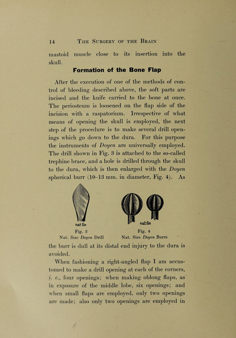mastoid muscle close to its insertion into the skull. Formation of the Bone Flap After the execution of one of the methods of con¬ trol of bleeding described above, the soft parts are incised and the knife carried to the bone at once. The periosteum is loosened on the flap side of the incision with a raspatorium. Irrespective of what means of opening the skull is employed, the next step of the procedure is to make several drill open¬ ings which go down to the dura. For this purpose the instruments of Doyen are universally employed. The drill shown in Fig. 3 is attached to the so-called trephine brace, and a hole is drilled through the skull to the dura, which is then enlarged with the Doyen spherical burr (10-13 mm. in diameter, Fig. 4). As Fig. 3 Fig. 4 Nat. Size Doyen Drill Nat. Size Doyen Burrs the burr is dull at its distal end injury to the dura is avoided. When fashioning a right-angled flap I am accus¬ tomed to make a drill opening at each of the corners, i. e., four openings; when making oblong flaps, as in exposure of the middle lobe, six openings; and when small flaps are employed, only two openings are made; also only two openings are employed in