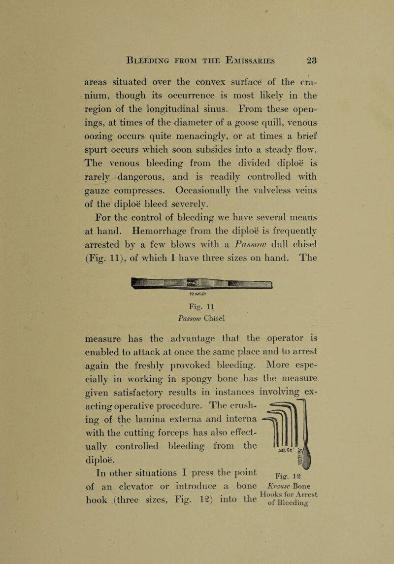 areas situated over the convex surface of the cra¬ nium, though its occurrence is most likely in the region of the longitudinal sinus. From these open¬ ings, at times of the diameter of a goose quill, venous oozing occurs quite menacingly, or at times a brief spurt occurs which soon subsides into a steady flow. The venous bleeding from the divided diploe is rarely dangerous, and is readily controlled with gauze compresses. Occasionally the valveless veins of the diploe bleed severely. For the control of bleeding we have several means at hand. Hemorrhage from the diploe is frequently arrested by a few blows with a Pas sow dull chisel (Fig. 11), of which I have three sizes on hand. The Vi a3.f.£r. Fig. 11 Pas sow Chisel measure has the advantage that the operator is enabled to attack at once the same place and to arrest again the freshly provoked bleeding. More espe¬ cially in working in spongy bone has the measure given satisfactory results in instances involving ex¬ acting operative procedure. The crush¬ ing; of the lamina externa and interna o with the cutting forceps has also effect¬ ually controlled bleeding from the diploe. In other situations I press the point of an elevator or introduce a bone hook (three sizes, Fig. 12) into the Fig. 12 Krause Bone Hooks for Arrest of Bleeding
